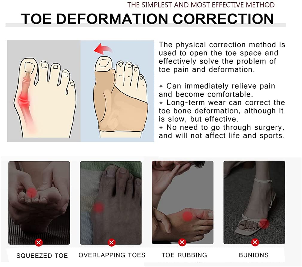 Toe Separator Sleeves, 2 Pairs Soft Breathable Big Toe Corrector with Gel Toe Spacer Cushion, Hammer Toe Overlapping Toes Straightener Sleeves for Big Toe Alignment Bunion Foot Pain Relief (L)