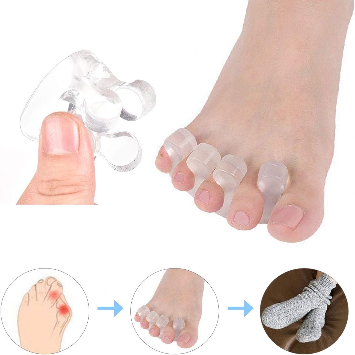 Gel Toe Separators Metatarsal Pads, Breathable Toe Straightener for Overlapping Toes, Bunion Corrector, Hallux Valgus Forefoot Pain Relief, Overlapping Toes, Blisters, Reusable Toe Stretchers