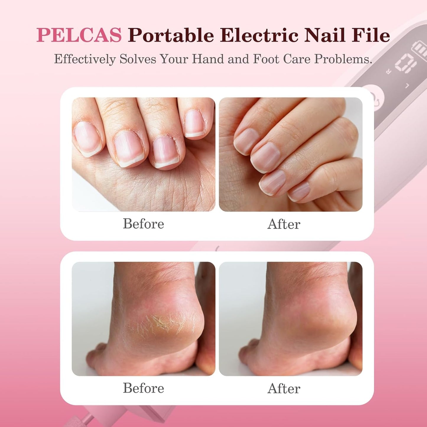 PELCAS Cordless Nail Drill, 10 Speeds Professional Electric Nail File with LED Light Portable Electric Toenail Files with LCD Screen for Thick Nails, Acrylic Nails, Polishing, Nail Art