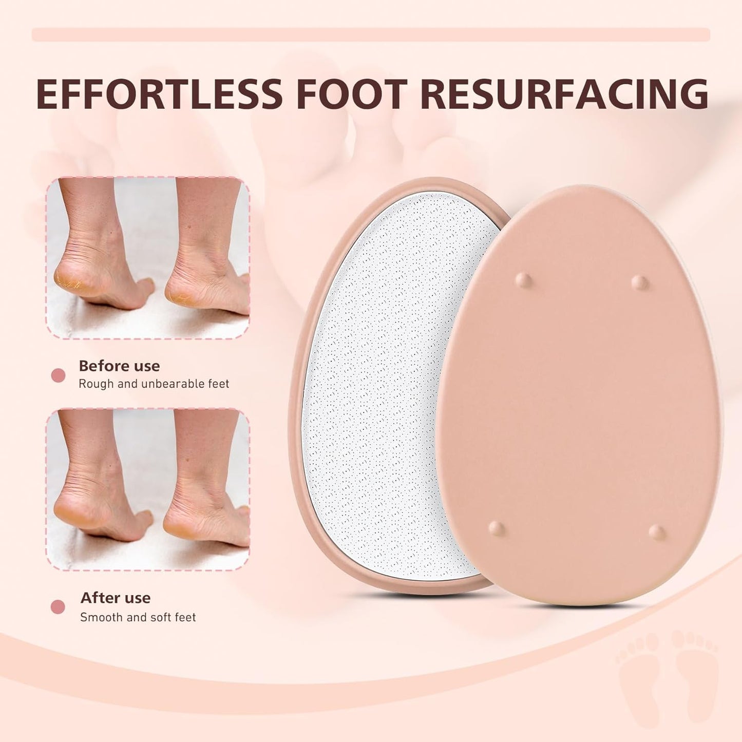BALUCA Glass Foot File Callus Remover for Feet - Nano Glass Foot Scraper Scrubber Dead Skin Removal for Cracked Heels,Professional Pedicure Tool for Home, Salon, and Travel (Apricot)