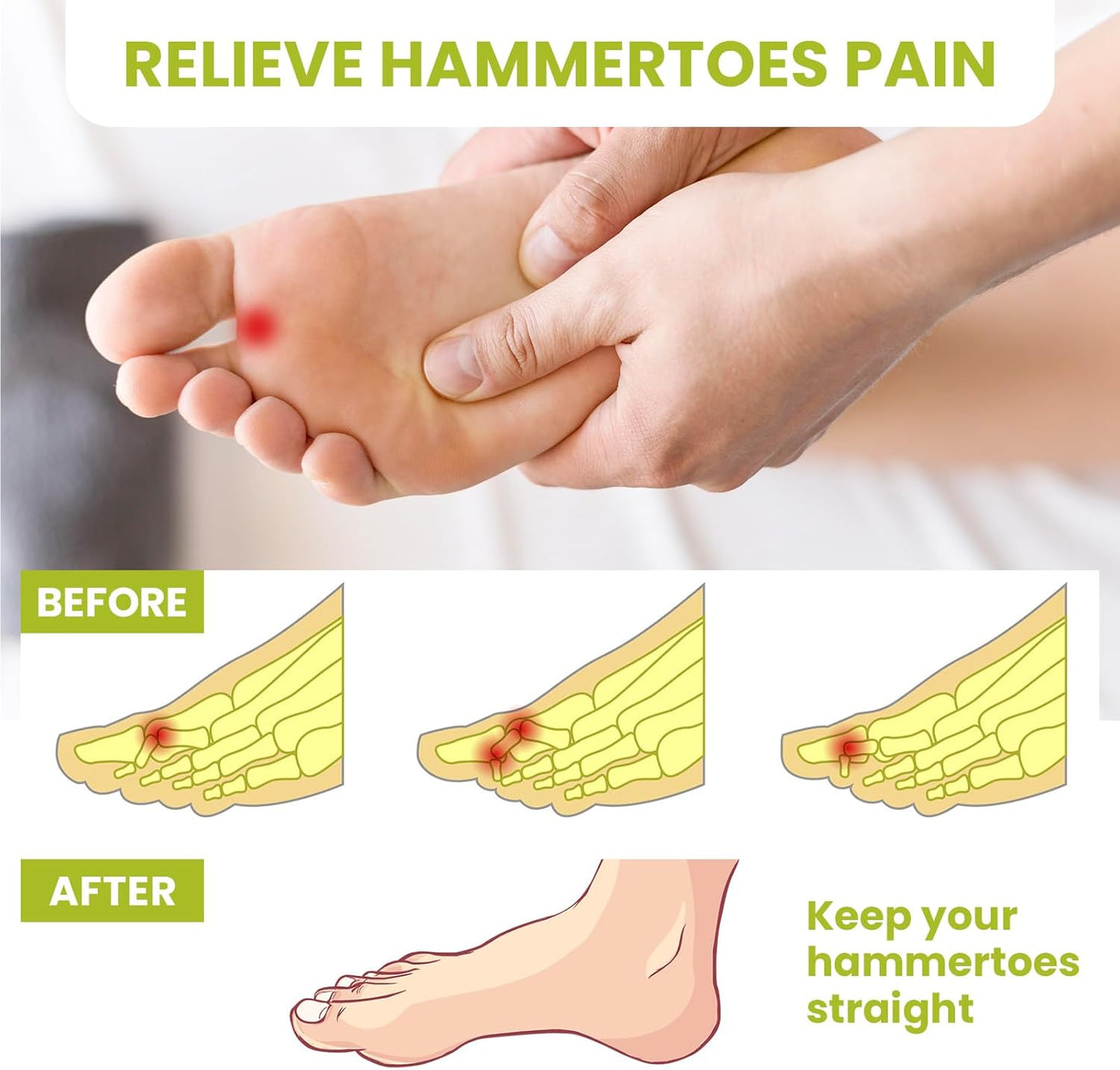 Bukihome Hammertoe Corrector Gel Toe Straighteners - 12 pcs Support Crest for Women & Men - Realign Bent, Crooked, Curled, Claw, Hammer Toes - Beige,Multi-Size