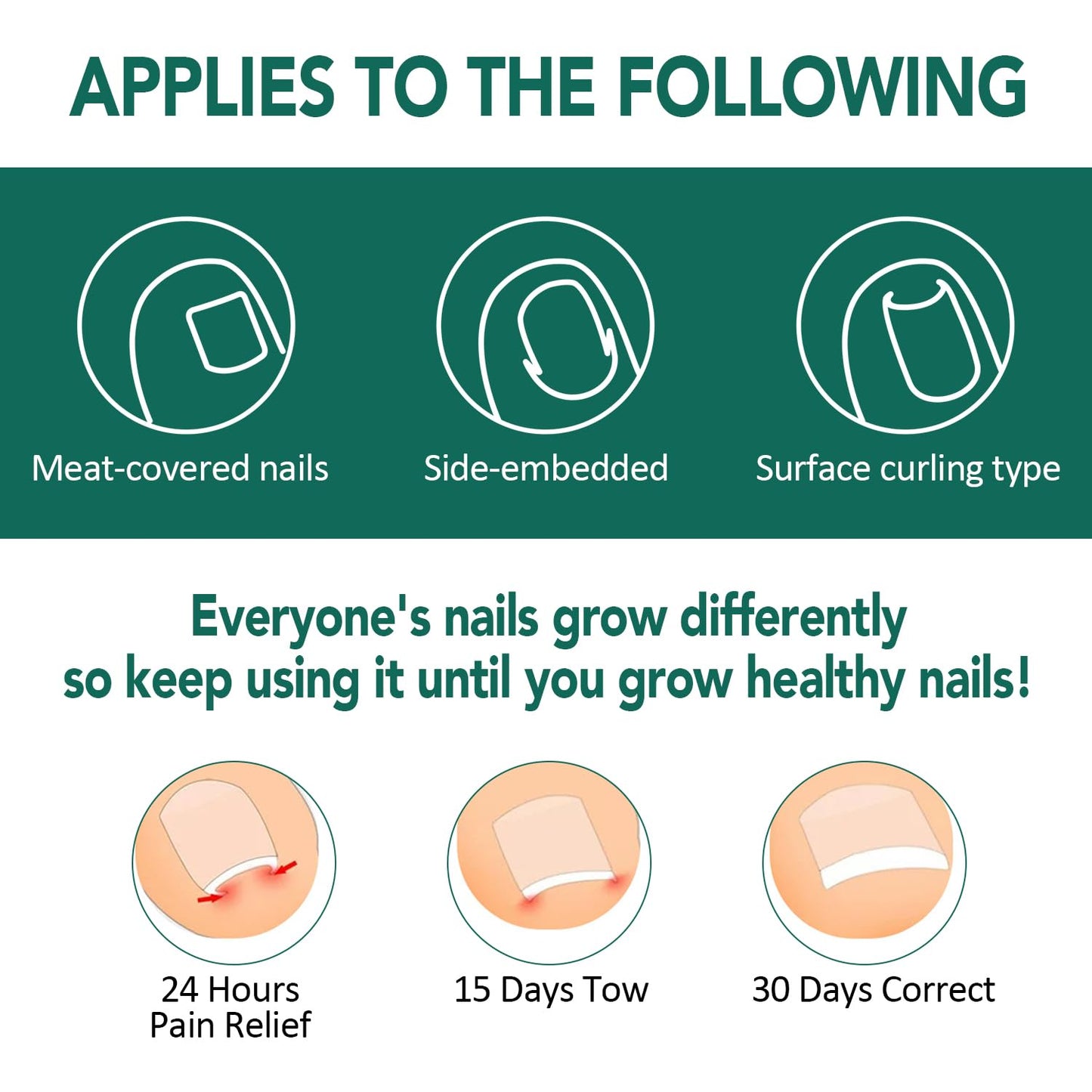 100pcs Ingrown Toenail Treatment, Breathable Ingrown Toenail Strips Ingrown Toenail Stickers, Toenail Corrector Patch with 3 Pedicure Tools for Ingrown Toenail