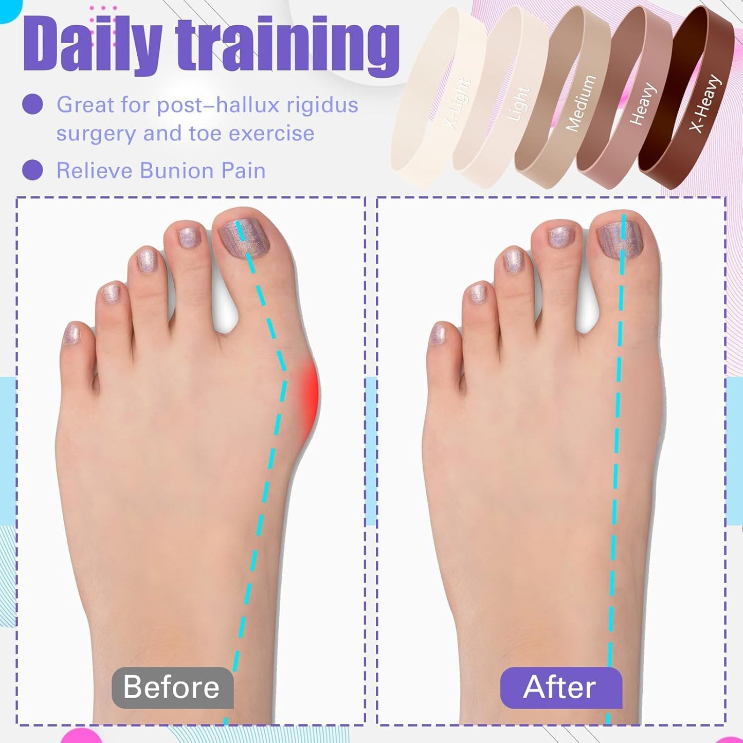 Set of 5 Toe Stretcher Bands for Bunions Correction Foot Big Toe Spacers Resistance Straightener Loop Bands with Carry Bag for Women Men Hallux Valgus Alignment Yoga Exercise(Coffee)