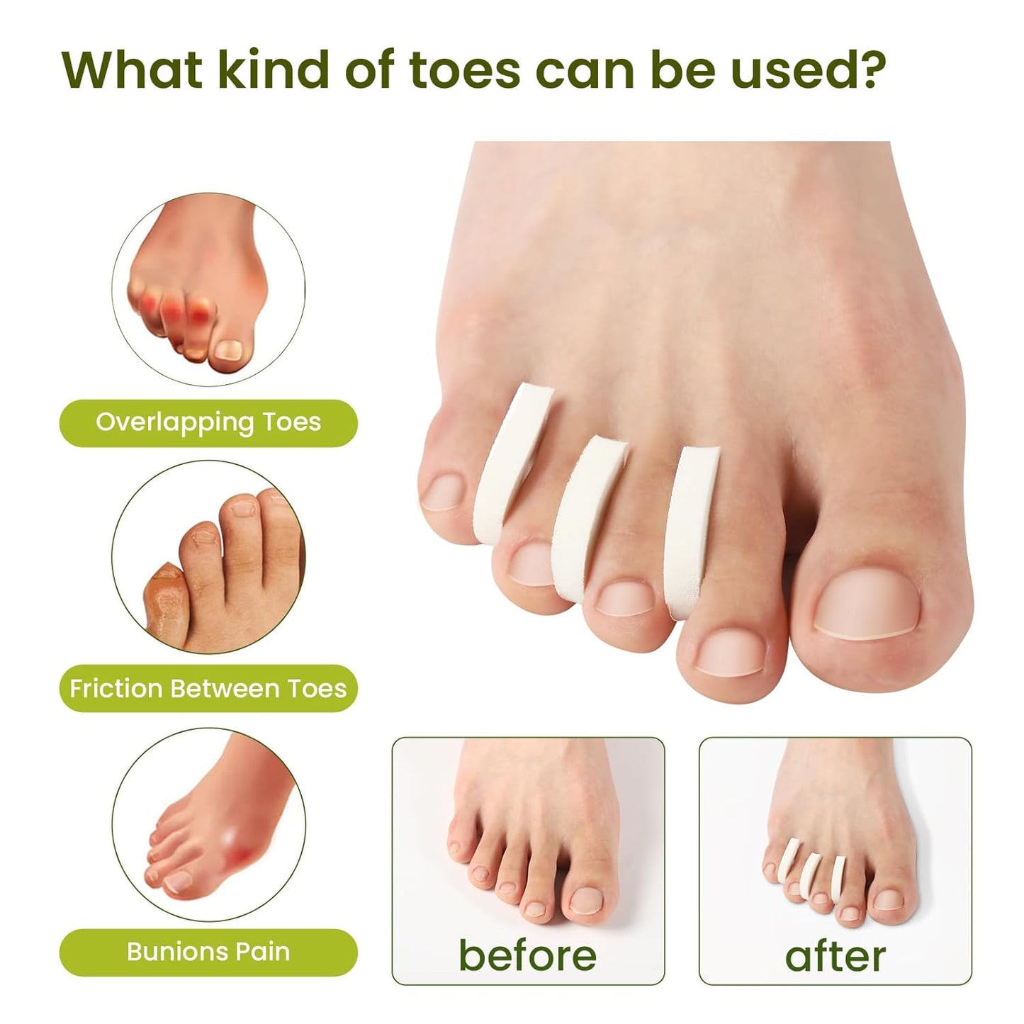 Bukihome 44-Pack Foam Toe Separators – Soft & Breathable Toe Spacers for Women & men, Help Align Overlapping Toes, Relieve Friction & Pressure, Ideal for Daily Comfort