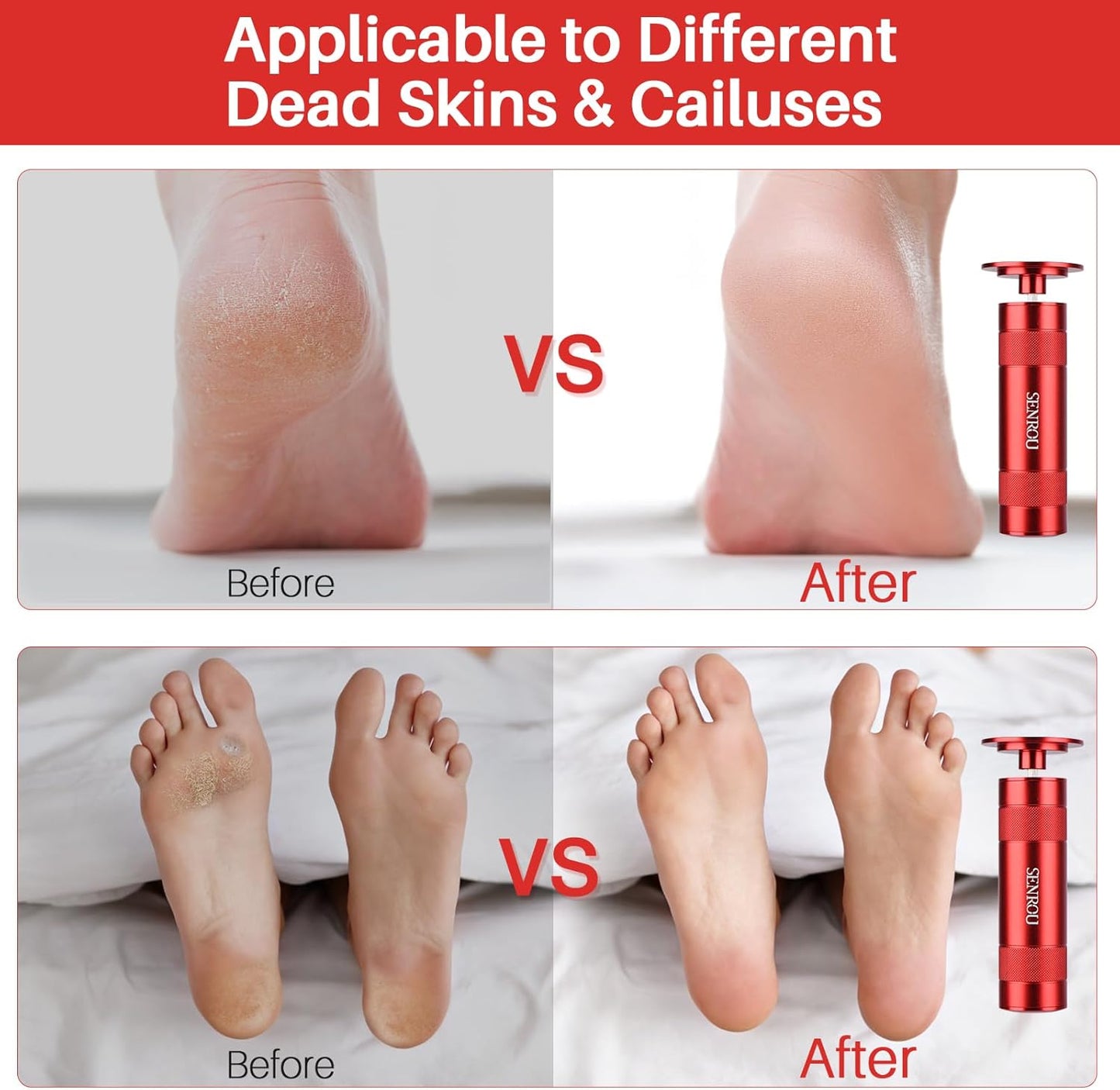 Electric Foot File, Callus Remover for Feet,Adjustable Speed 2 in 1 Electric Foot File Nail Grinder with 60 Pcs Sandpaper Discs, Tool for Dead Skin and Calluses,Gift for Women, Men- Red