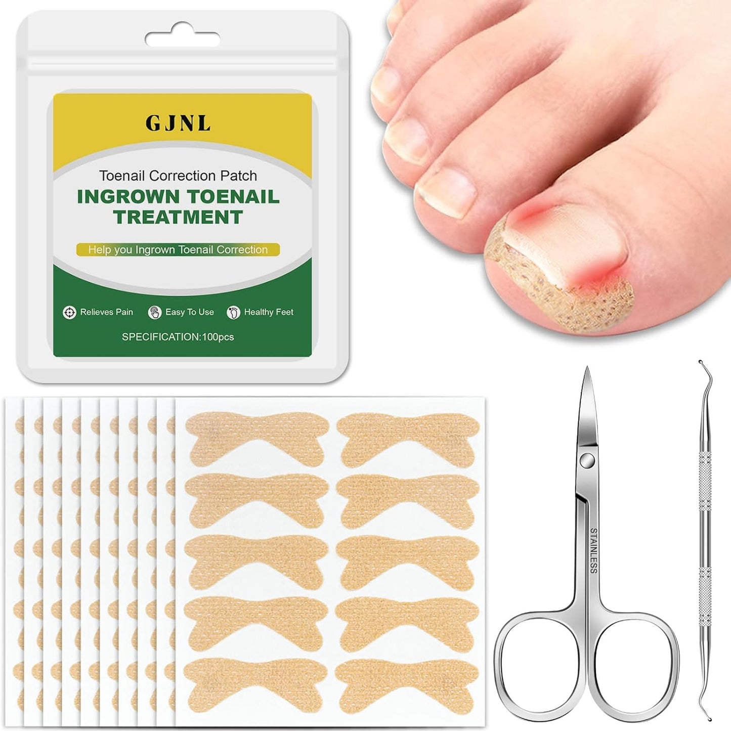 Ingrown Toenail Treatment,100 Pcs Breathable Ingrown Toenail Strips-Toenail Lifter and Small Scissors, Painless Ingrown Toenail Tool, Professional Pedicure for Ingrown Toenail, Toenail Corrector Patch