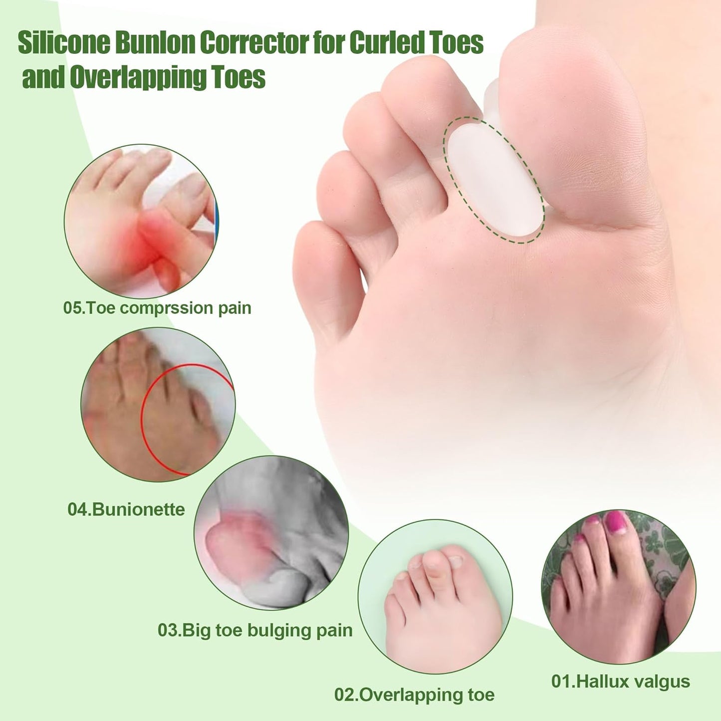 FOYOLO Gel Toe Separators and Flared Bunion Spacers 8PCS Temporary Bunion Corrector,Toes Splint Gel Toe Spacers for Overlapping Toe and Curled Toes,Stay in Place-(2 Small & 6 Large Size-Clear)