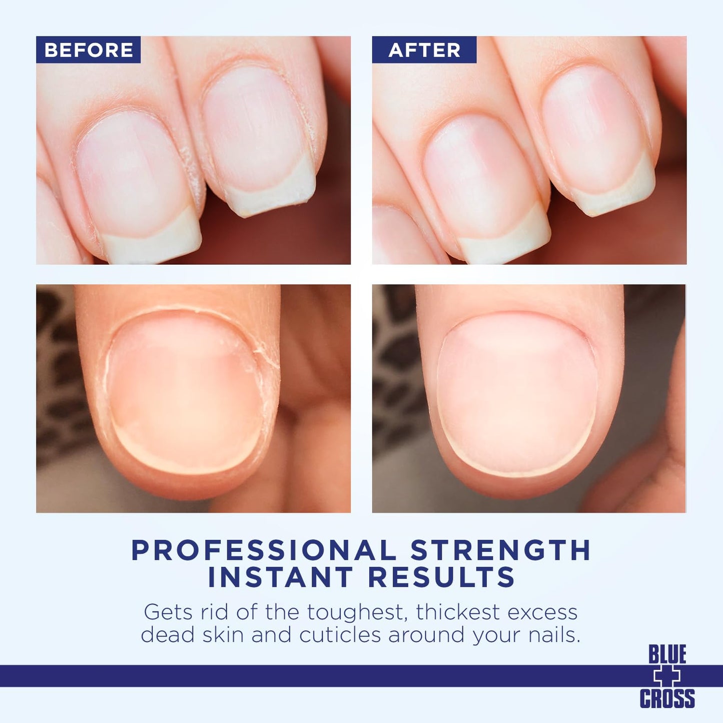 Blue Cross Cuticle Remover Cream 1oz + Professional Nail Care Oil for Dry Damaged Cuticles 1oz, 2 Pack Gift Set, Made in USA