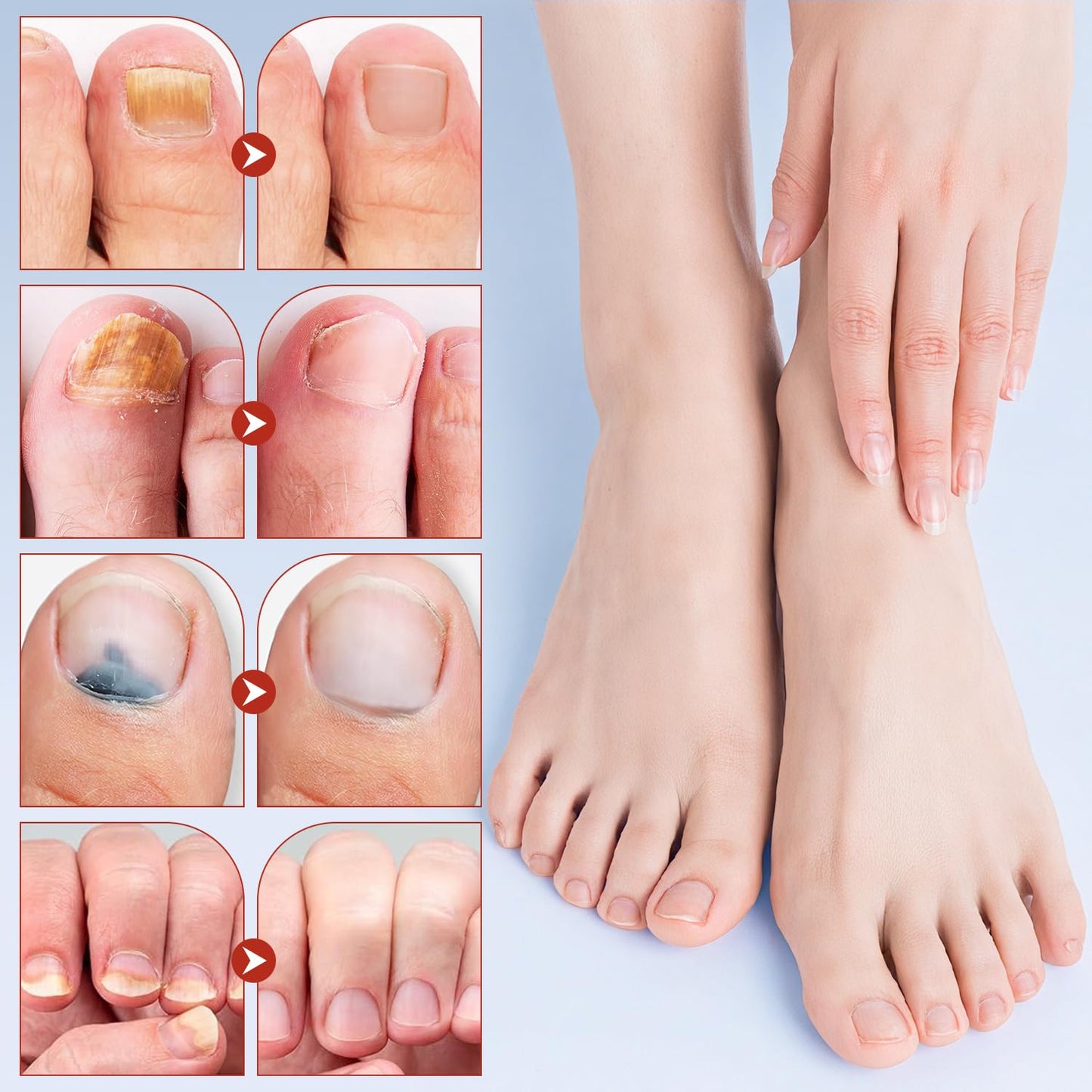 Toenail Extra Strength Nighttime Renewal Nail Patches, 21 Patch, Overnight Repair for Nail, 8-Hour Repair Appearance