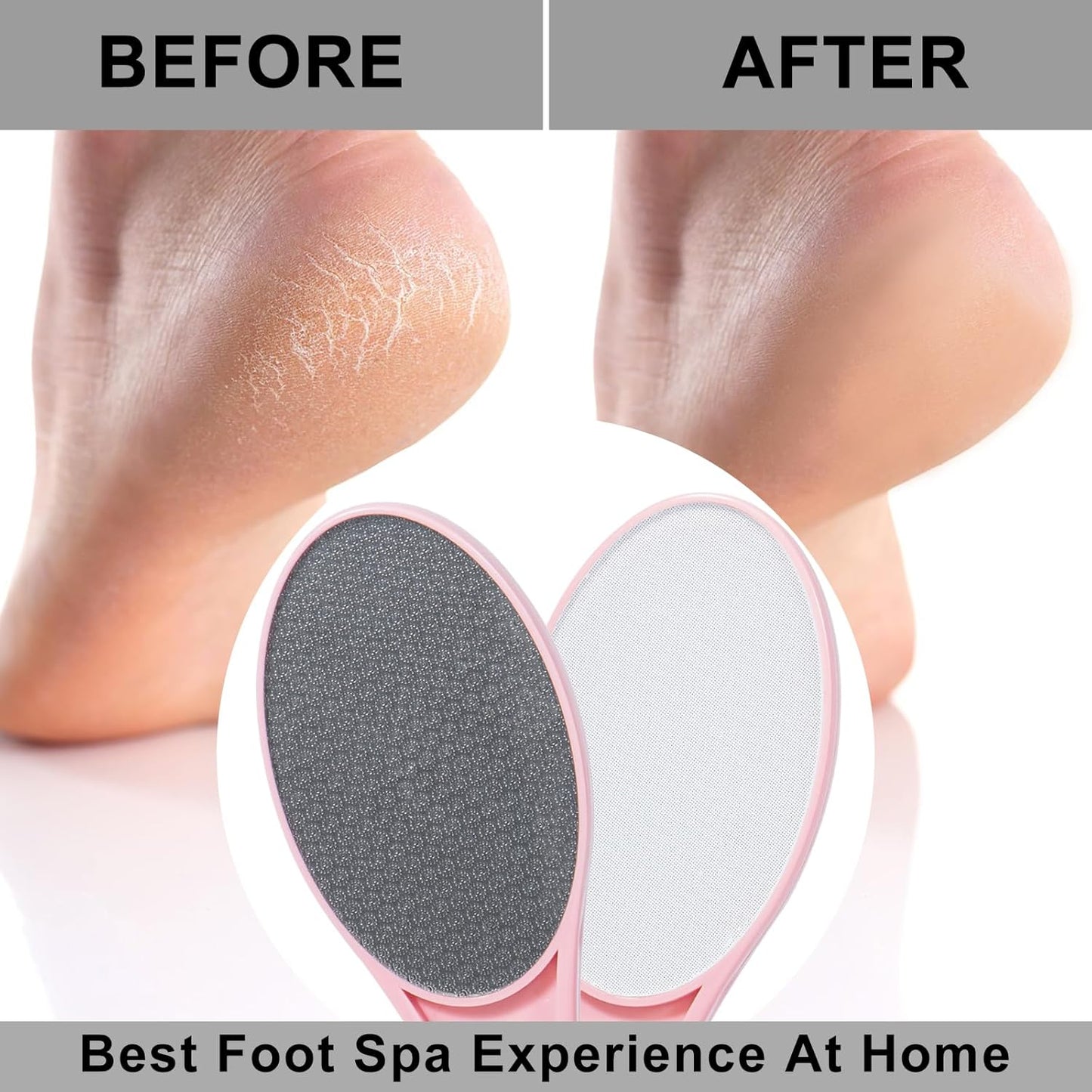2 Pack Nano Glass Foot File Callus Remover, Beomeen Hard and Dead Skin Remover for Feet, Double Sided Foot Scrubber Pedicure Tool, Hair Eraser for Softer & Smoother Feet, Random Black/White Glass