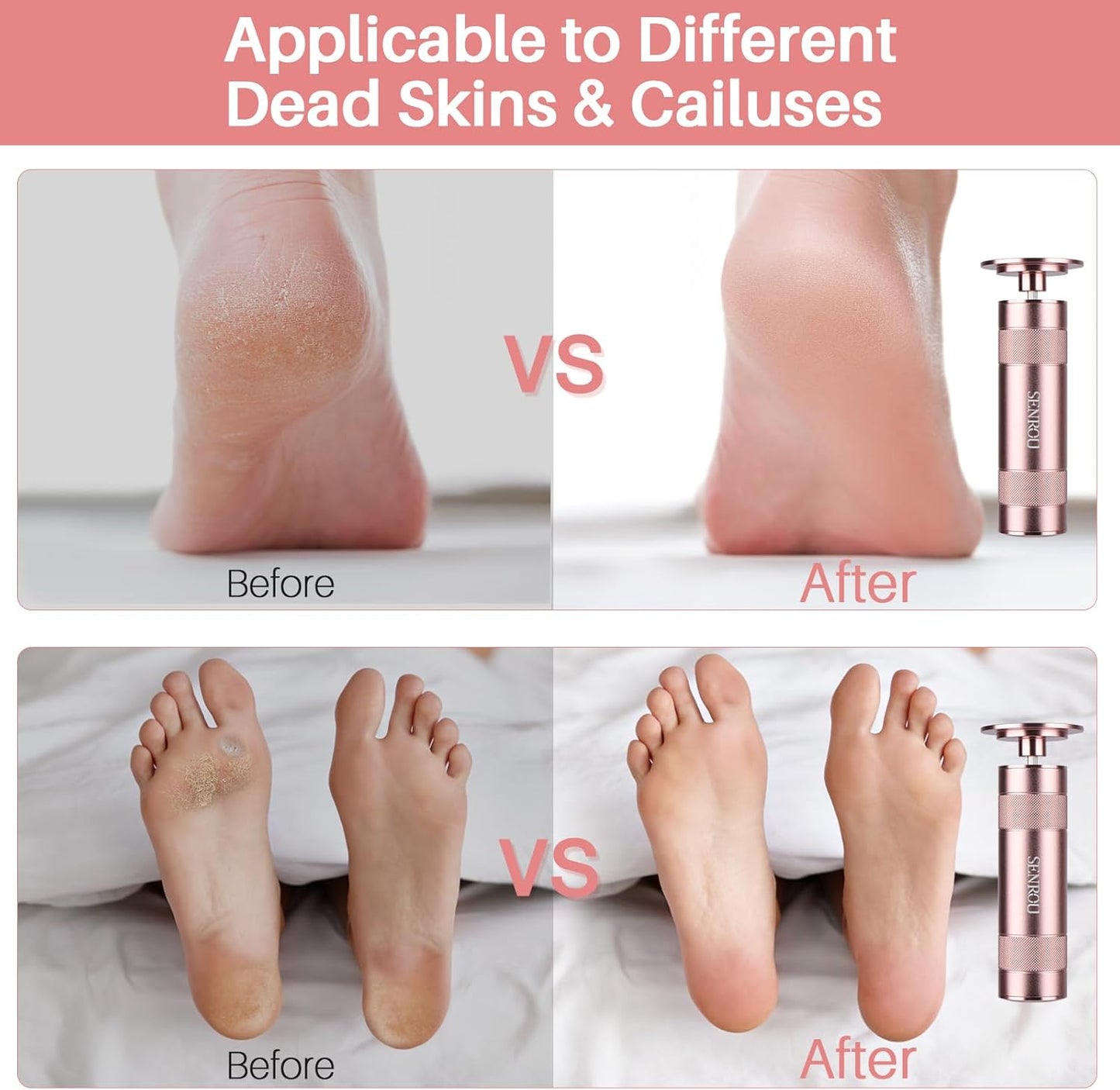 Electric Foot Callus Remover, 2-in-1 Electric Foot Filer/Nail Filer, Callus Remover for Feet with 60Pcs+12Pcs Sandpaper Discs，Holiday Gift Foot Repair Tool, Champagne Gold