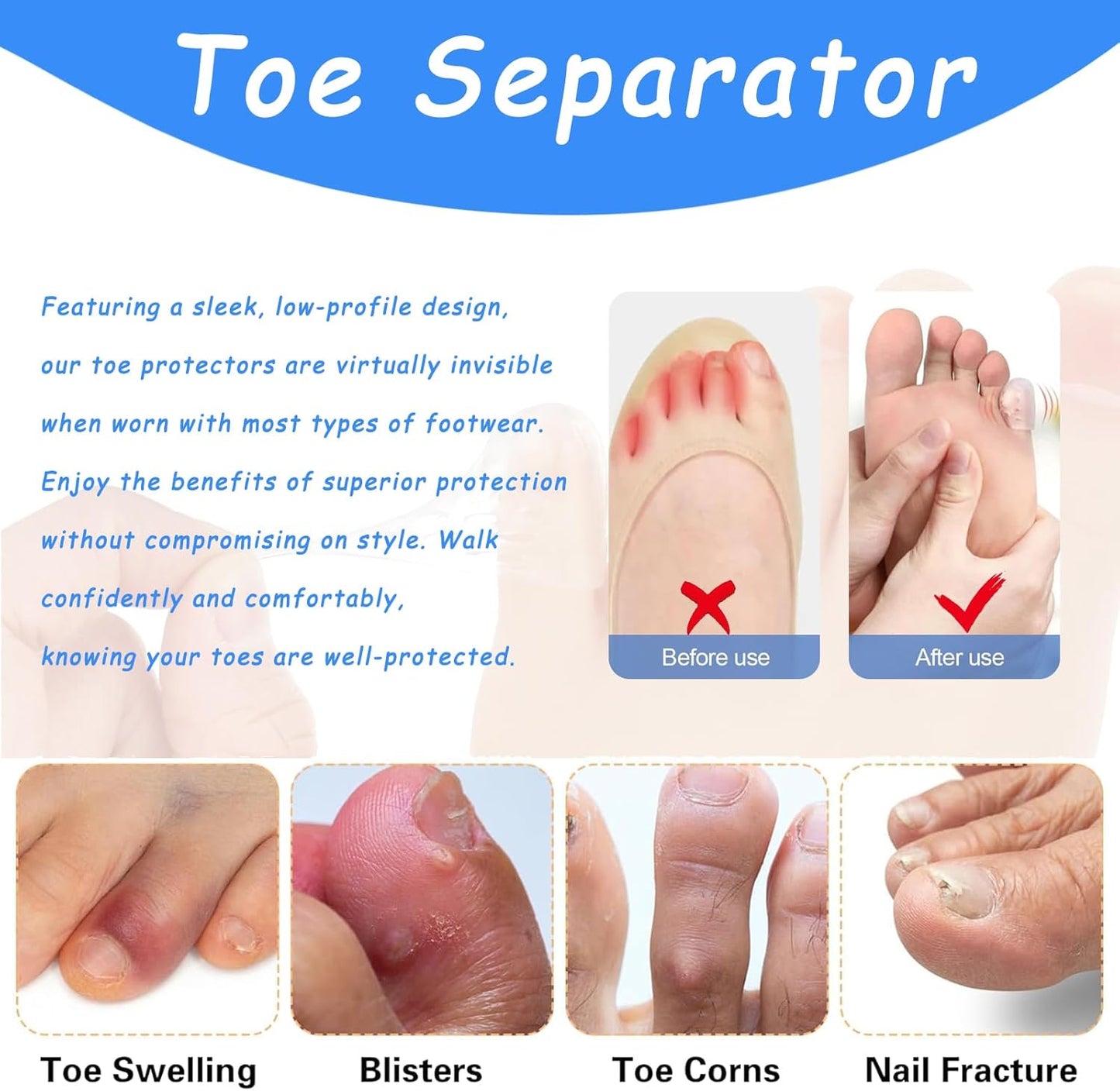 Silicone Anti-Friction Toe Protector, Silicone Toe Protectors, Gel Toe Protectors, Breathable Little Toe Covers, Blisters, Calluses, and Corns Protection (10PCS)