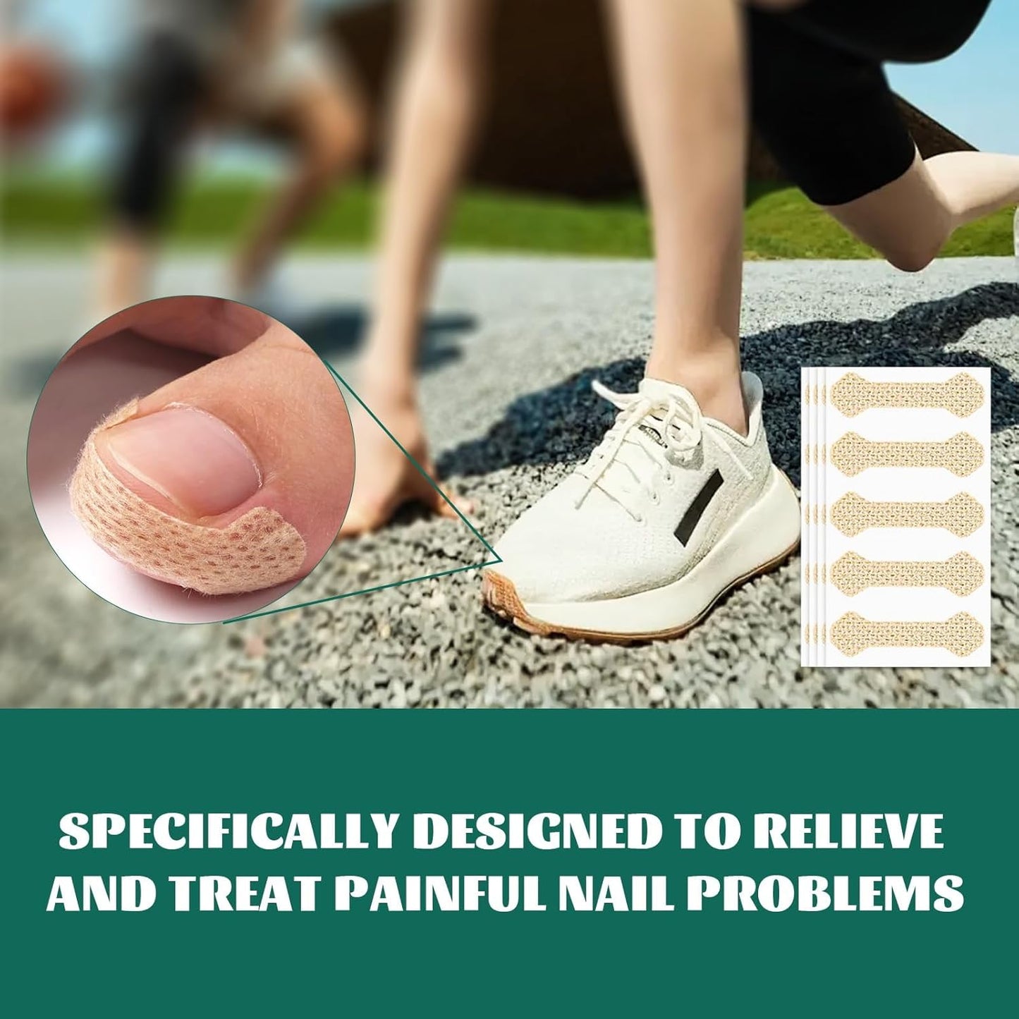 Ingrown Toenail Treatment, 60Pcs Breathable Ingrown Toenail Strips,Painless Ingrown Toenail Tool, Professional Pedicure for Ingrown Toenail, Toenail Corrector Patch