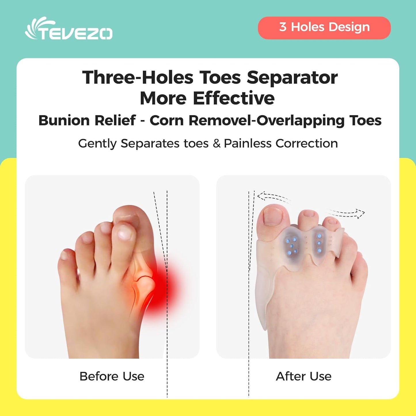 Toe Spacers & Bunion Corrector for Men&Women|Toe Separators,Corn Callus Removers|Hammer Toe Straightener|Bunion Relief|Overlapping Toes Separators|Corn Pads for Toes|1 Pair (Large)