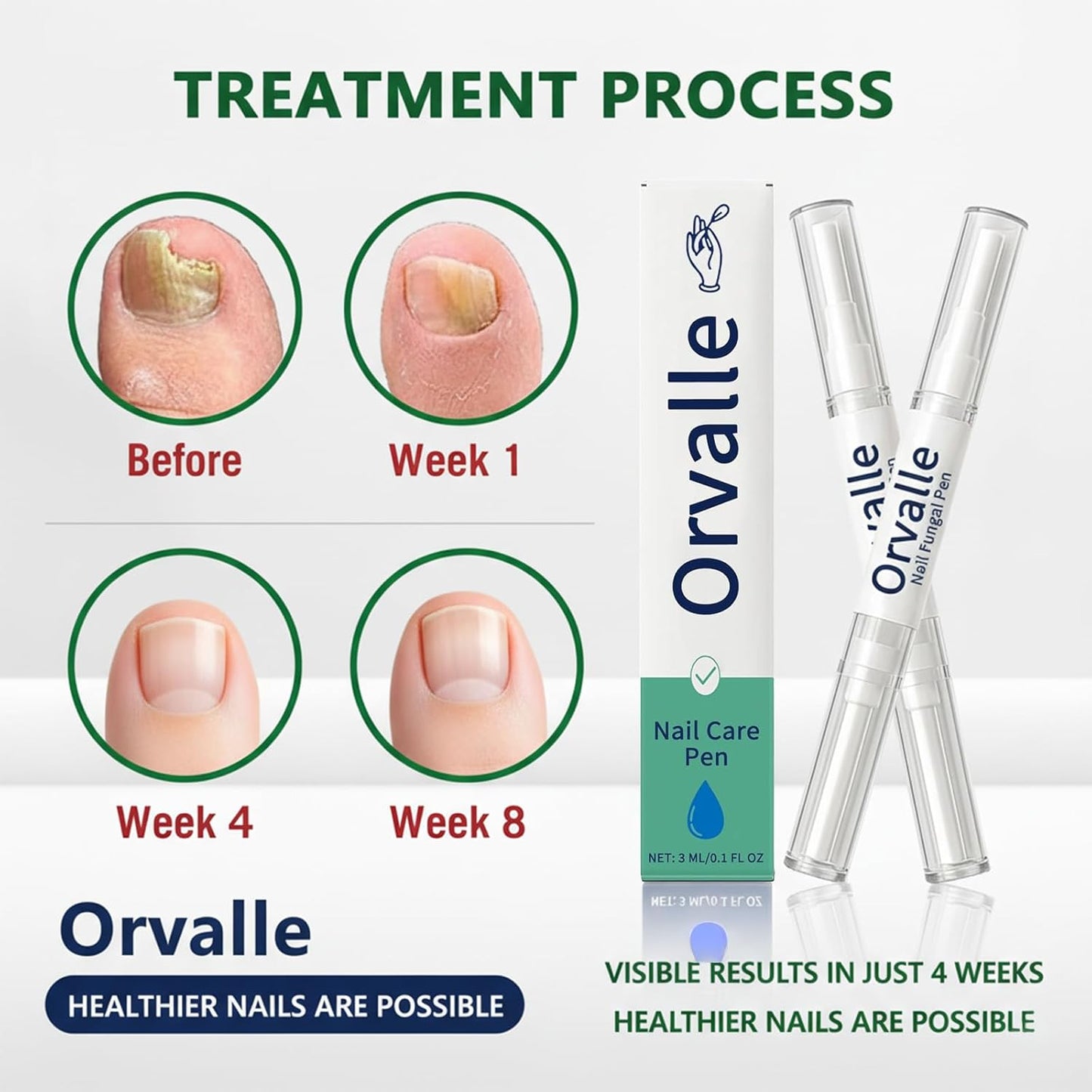 Orvalle Nail Fungus Pen,Toenail fungus pen,Nail Growth Pen for Repair & Strengthener,Nail Growth Treatment Repair Serum Twist Pen Activator for Repair & Strengthener(2pcs)