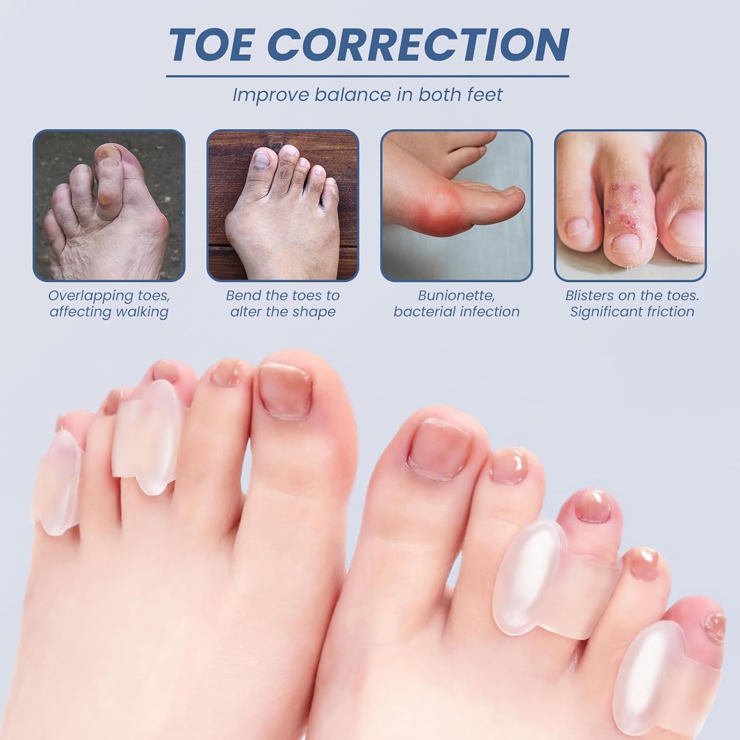 10 Pcs Gel Toe Separator, Pinky Toe Spacers Straightener Bunion Corrector Silicone Toe Separators for Toe Straightening and Relaxation for Women Men Correct Overlapping Toes