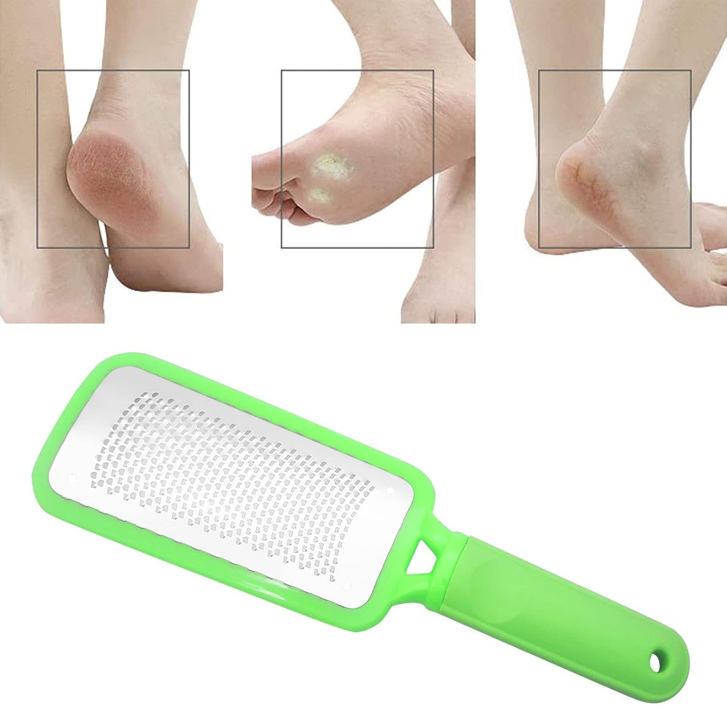 Professional Foot Files Callus Remover,Foot Scrubber for Dead Skin,Stainless Steel Foot Rasp-Green（1 Pack）