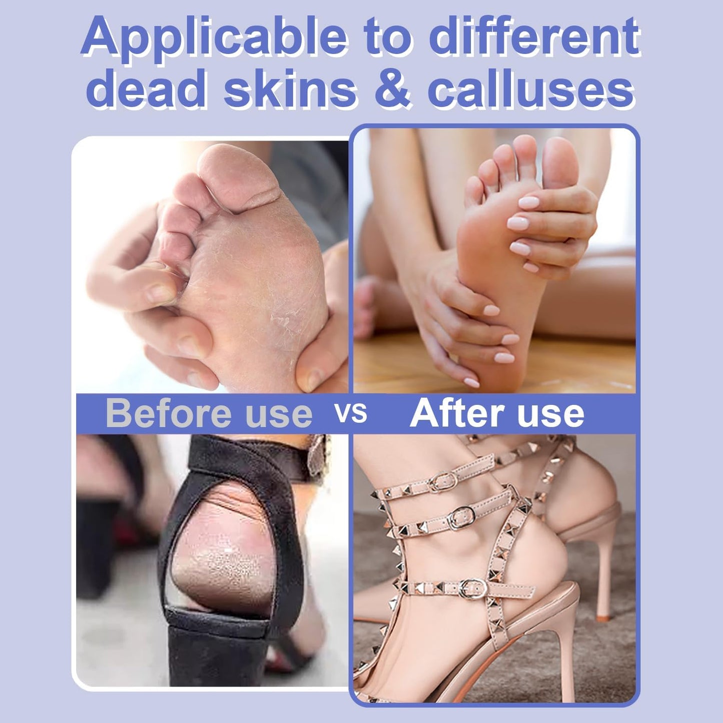 Electric Foot File - High Torque,Callus Remover for Feet,Adjustable Speed Foot File with 60 Pcs Sandpaper Discs,Professional Pedicure Tool for Dead Skin and Calluses (Blue)