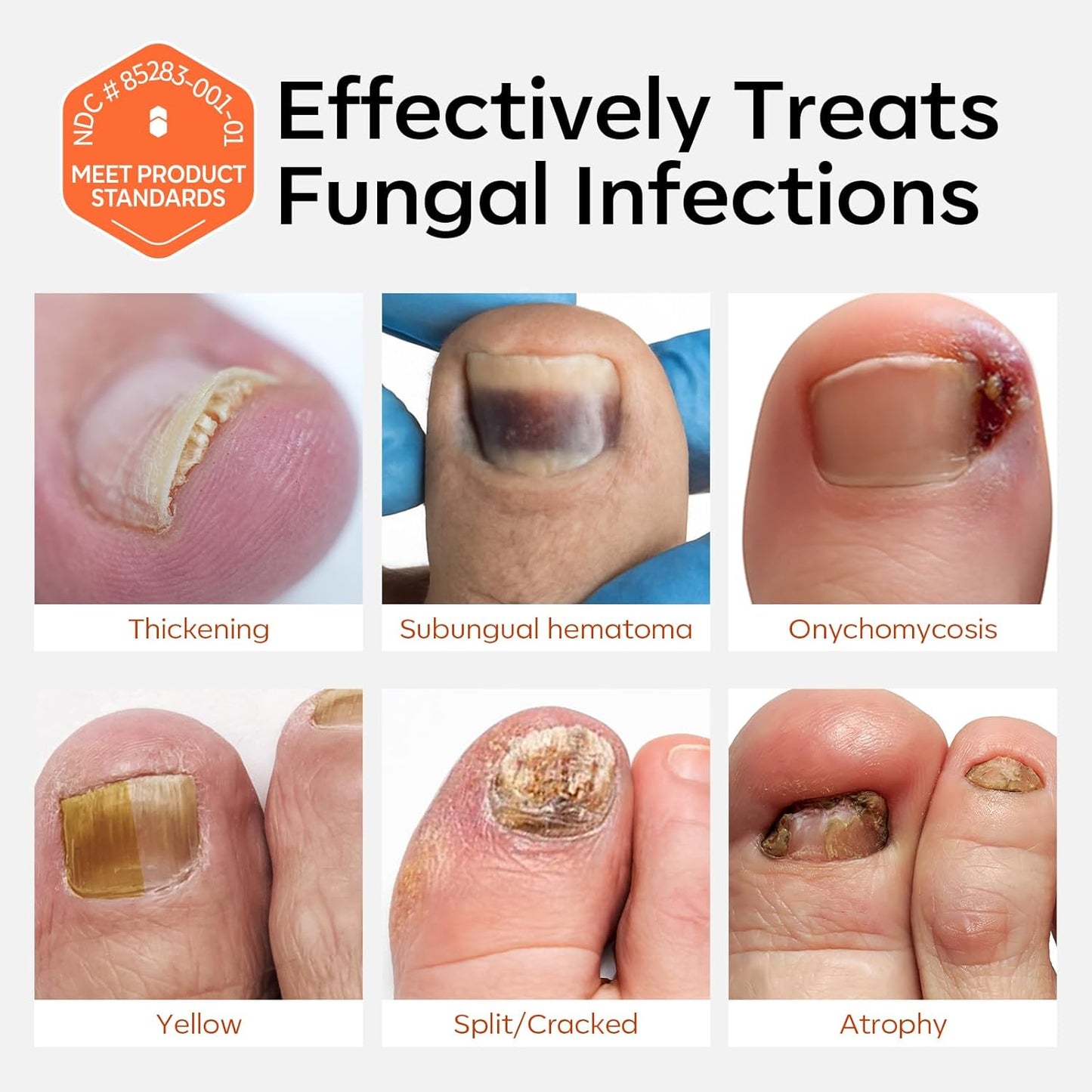 modelones Toenail Fungus Treatment Extra Strength 7days Nail Fungus Treatment for Toenail and Fingernail With Brushes Head Nail Repair for Damaged Nails Antifungal Nail Polish 30ML 1Fl Oz
