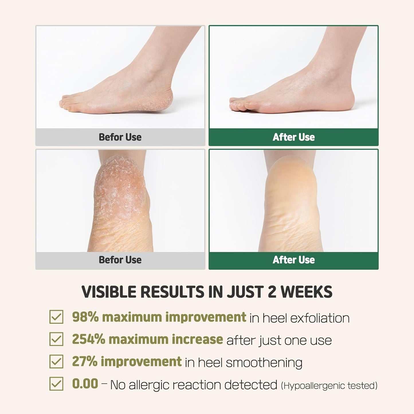Heartleaf Peelief Foot patch 1box 8ea | Removing Dry, Cracked, and Dead Skin | Peeling Patch | Exfoliant for Peeling Off Calluses | Korean Skincare