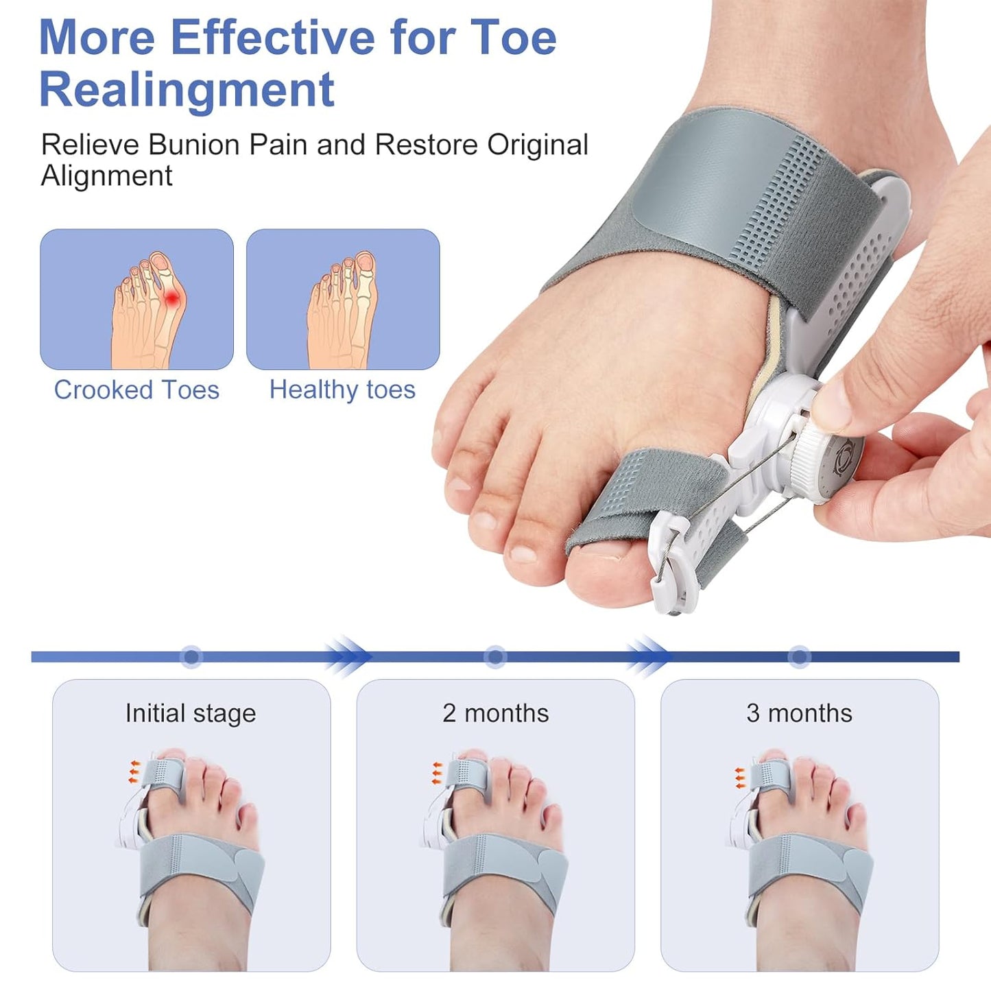 Bunion Corrector for Women Men, Adjustable Bunion Fix for Big Toe Separation Pain Relief with Non Slip Big Toe Separators, Orthopedic Bunion Splint for Left/Right Feet Hallux Valgus Relief (1PCS)