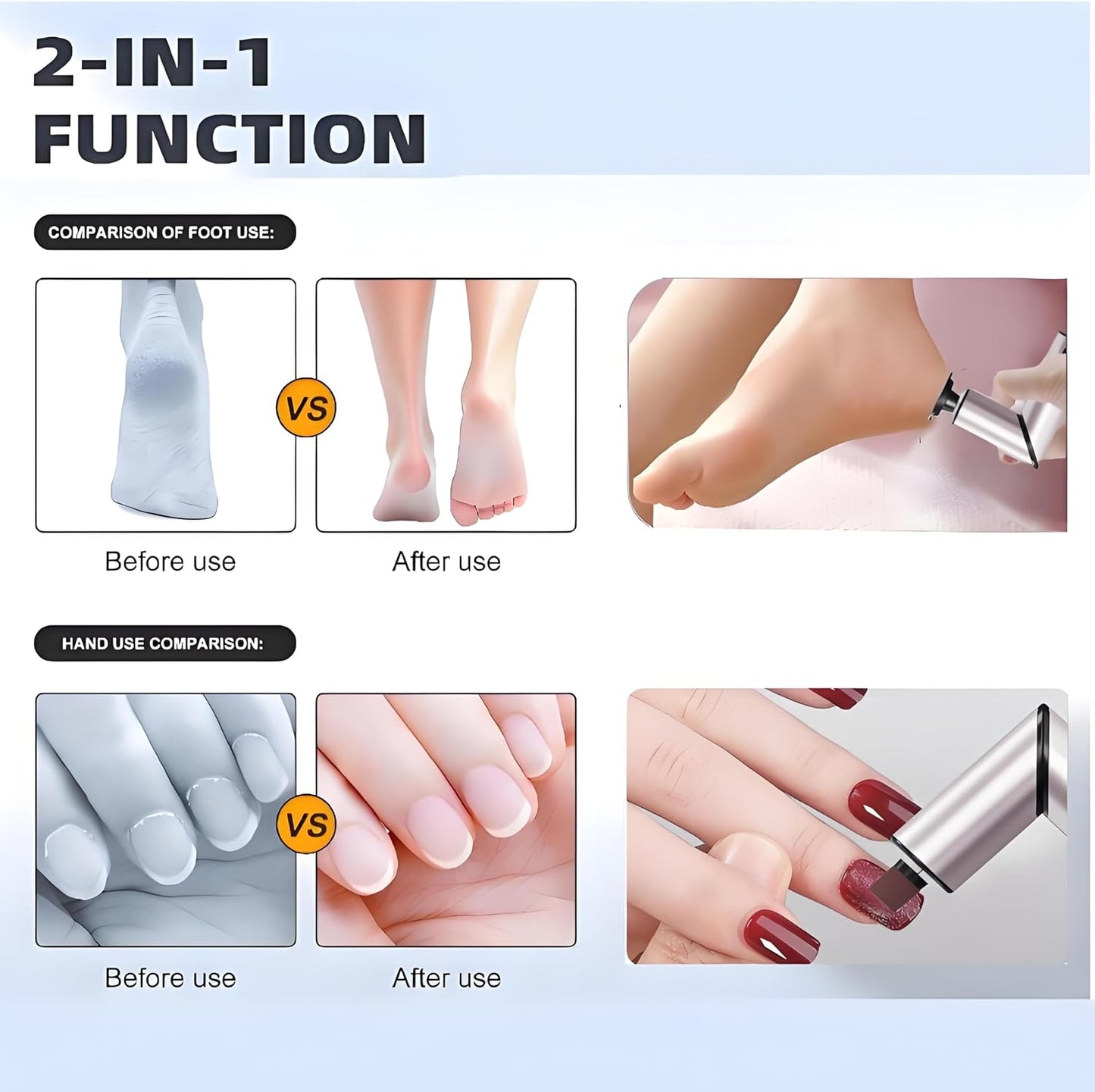 Foldable Electric Foot Callus Remover, Foot Files, 9-Speed Foot Sander Pedicure Tools for Feet Dead Skin with Sandpaper Disk and Nail Care（Rose Gold）