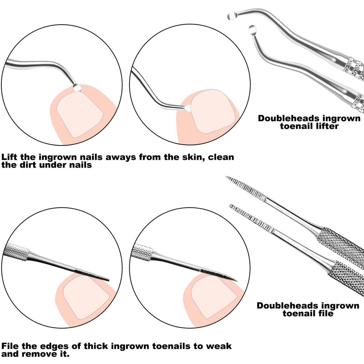 ZIZZON 7 Pcs Ingrown Toenail File and Lifters Set, Stainless Steel Ingrown Toenail Removal Kit, Under Nail Cleaner Pedicure Tools