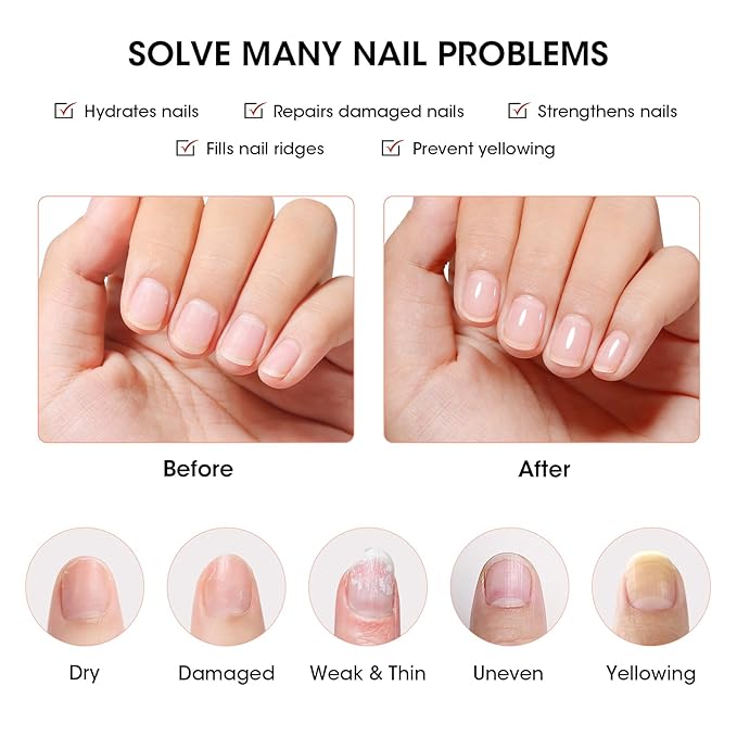 GELLEN Clear Nail Polish Ridge Filling Base Coat, Nail Strengthener and Growth, Ridge Filler For Nails, Hydrate Strengthen Nourish Damaged Dry Natural Nails, Shea Butter & Vitamin E & Protein Formula