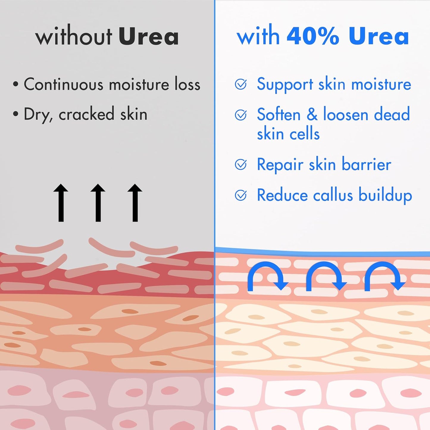 Ebanel Urea Cream 40% plus Salicylic Acid 2%, Foot Cream for Dry Cracked Heels Feet Knees Elbows Hands, Foot Dead Skin Cuticle Callus Remover Toenail Softener, Keratolytic Skin Barrier Repair, 2-Pack