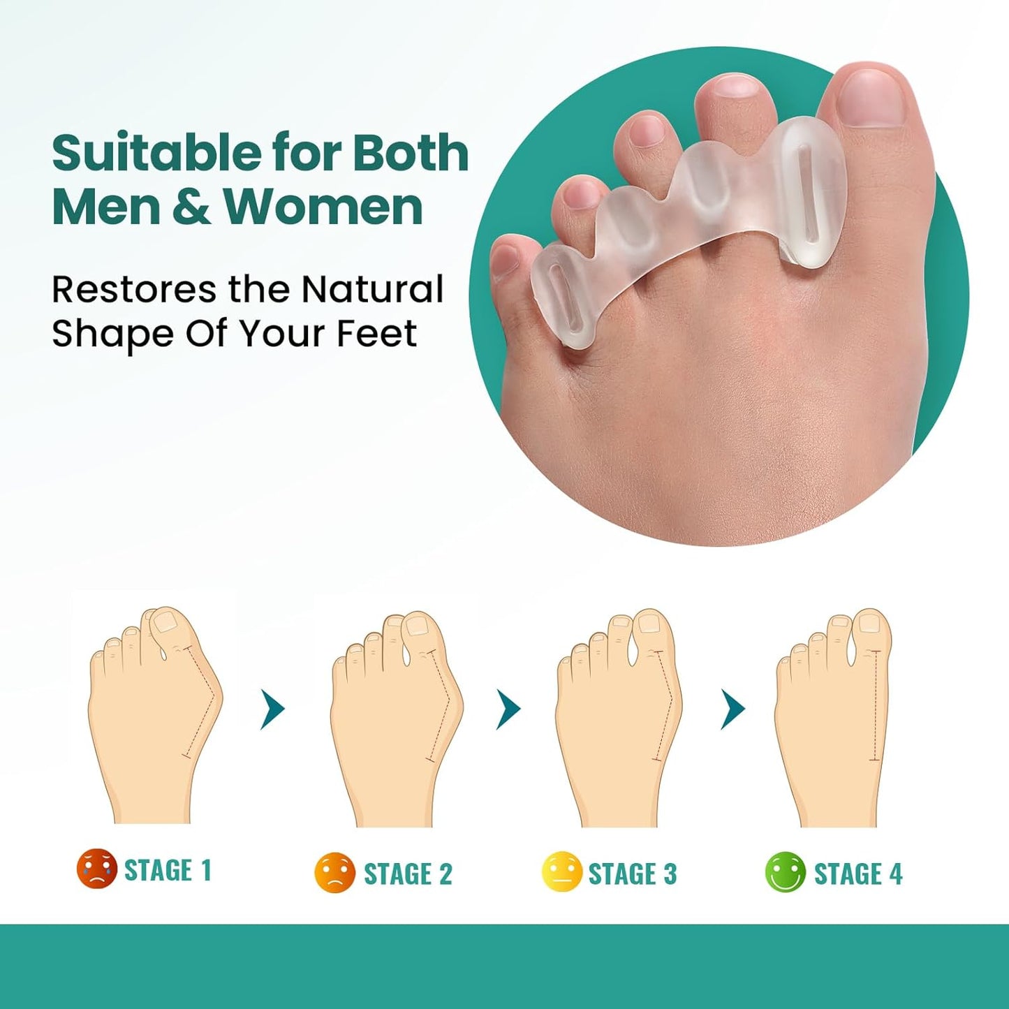Welnove Toe Separators - 2 Pairs Toe Spacers for Women Men to Correct Bunion, Toe Straighteners for Plantar Fasciitis, Hammertoes, Relieve Feet Pain, Foot Alignment - S