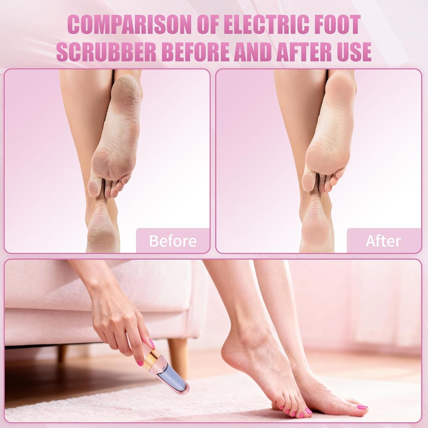 Pedicure Tool, Foot Callus Remover, Electric Pedicure Set, Foot Care, Removes Rough Dead Skin on The Feet, Making Your Feet Smooth. (Pink)