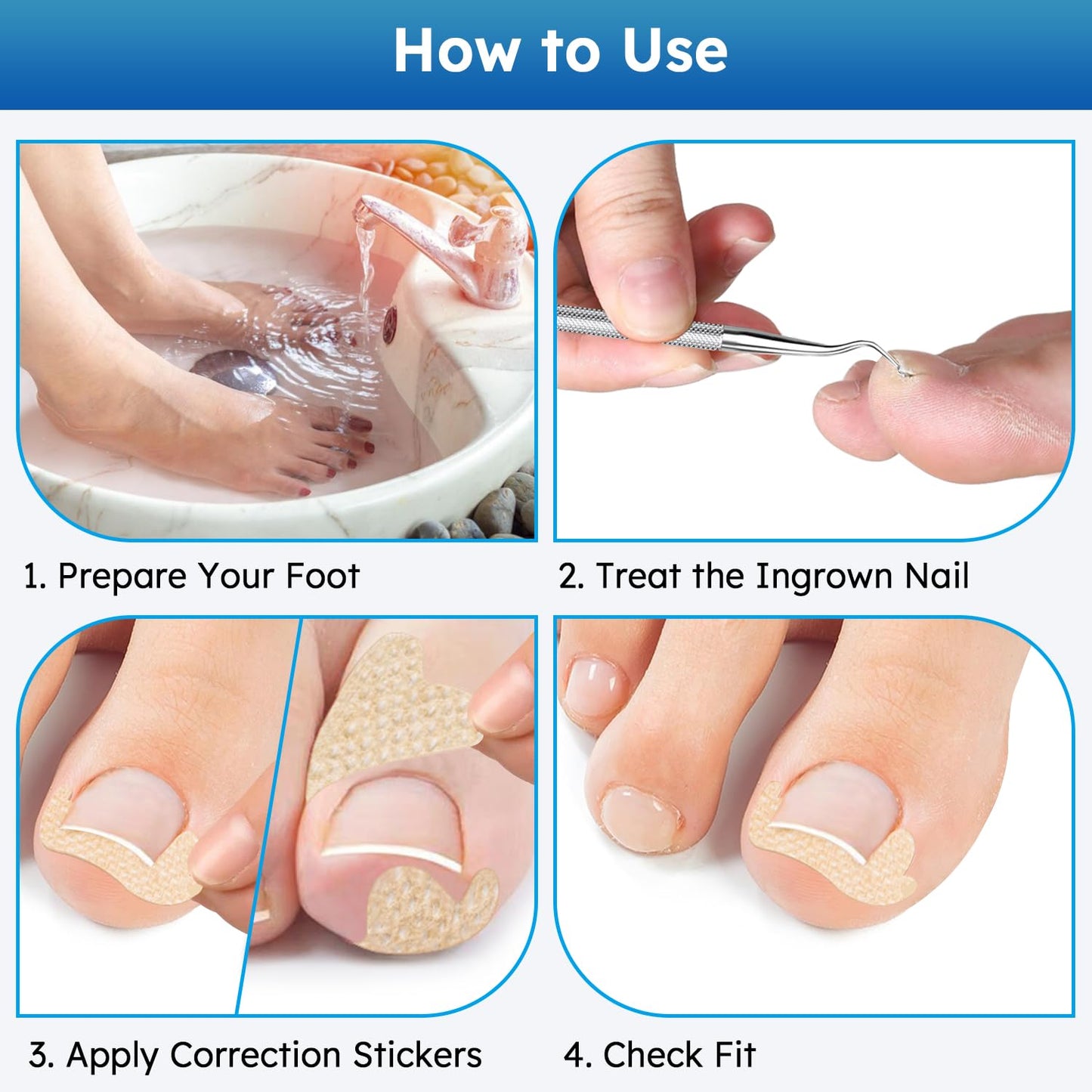 Ingrown Toenail Treatment, No Glue Breathable Curved Toenail Corrector，Ingrown Toenail Corrector Strips with File and Lifter, Professional Nail Correction Stickers 60Pcs