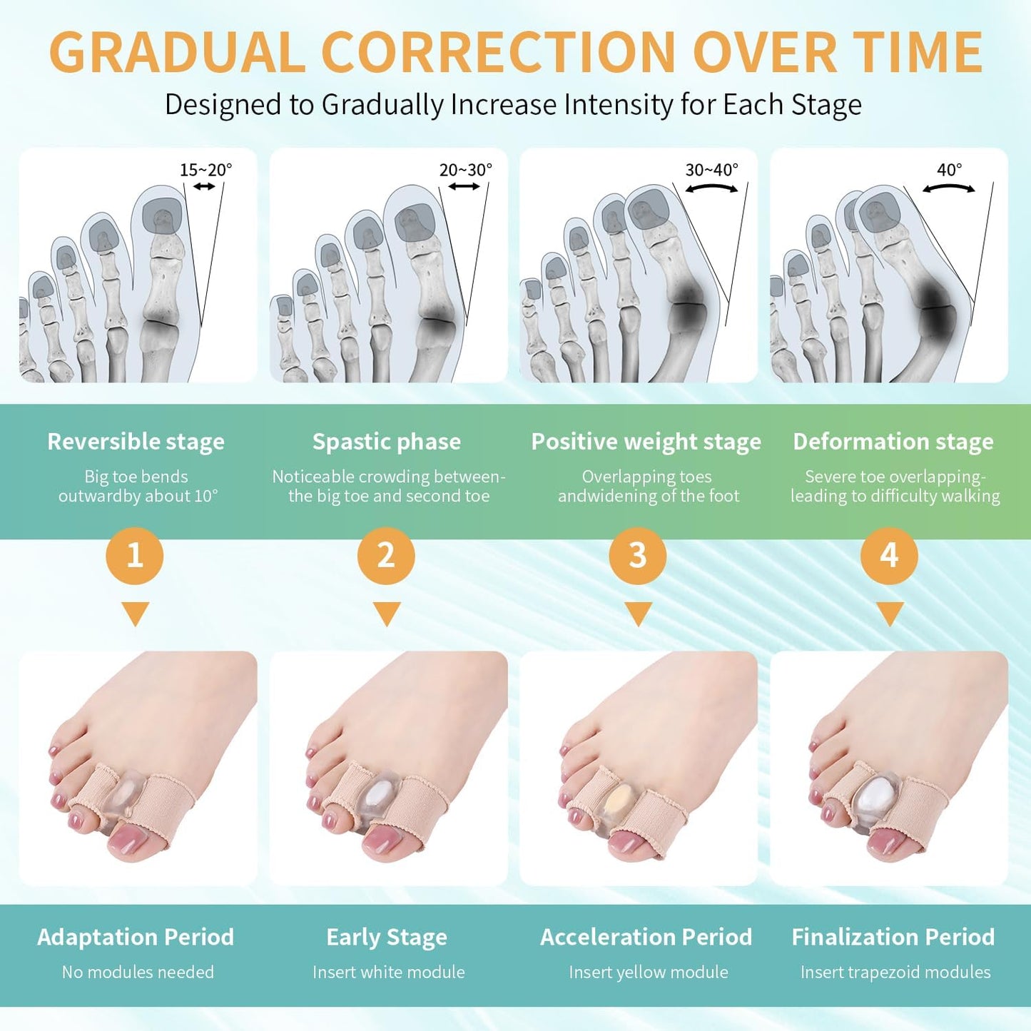 Adjustable Big Toe Separators for Women & Men Bunion Corrector & Hammer Toes Straightener, Silicone Spacers for Overlapping Toes, Corn Relief & Foot Pain Support, Soft Gel Protectors