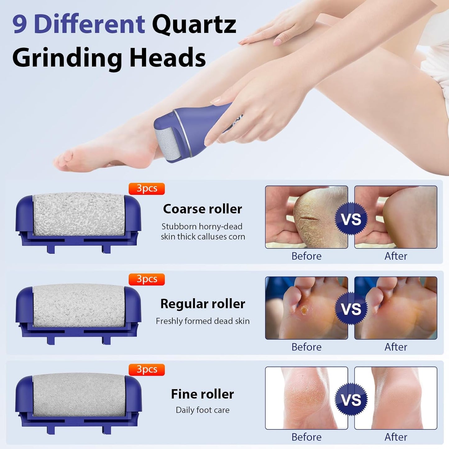 Electric Callus Remover for Feet, Rechargeable Portable Electronic Foot Callus Remover 2-in-1 Wet/Dry Foot Scrubber Electric Toot File for Hard Cracked Dry Dead Skin（Blue）