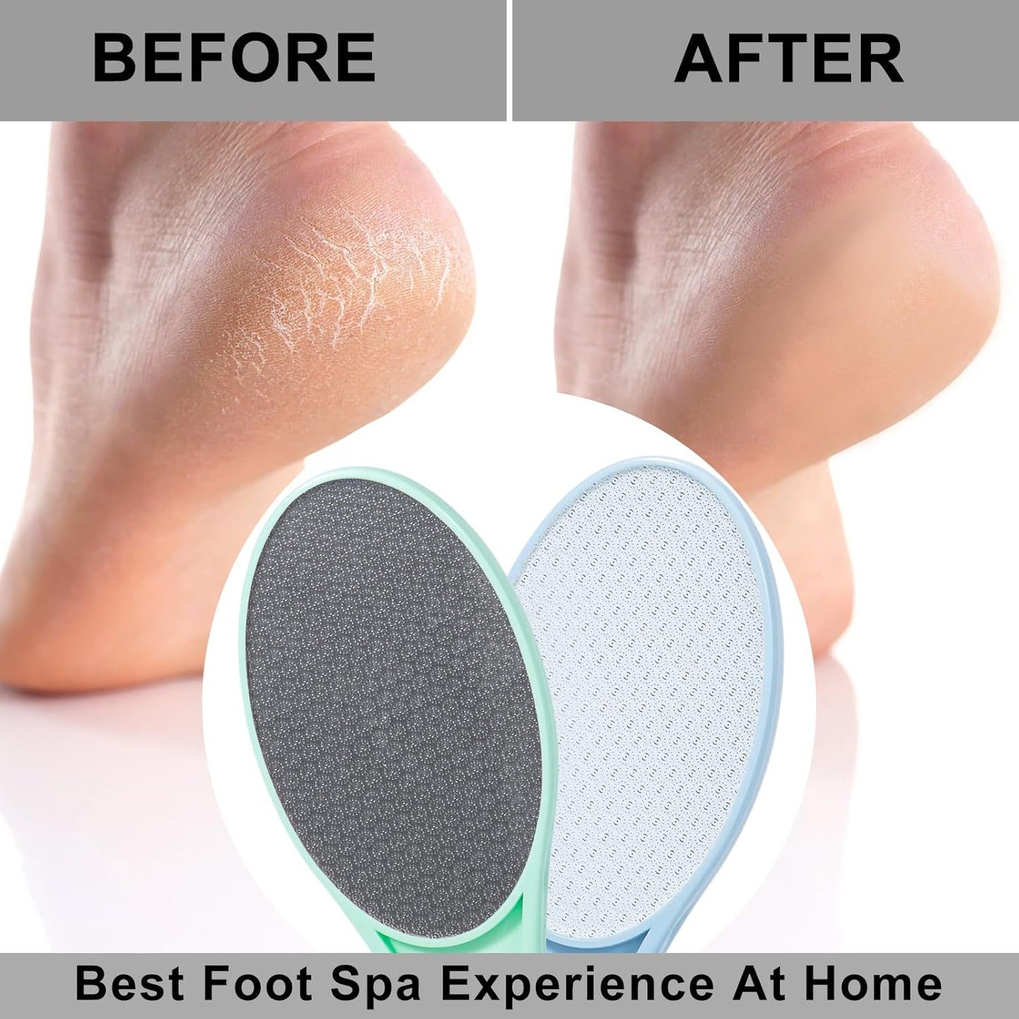 Nano Glass Foot File Callus Remover, 2 Pcs Hard and Dead Skin Remover for Feet, Double Sided Foot Scrubber Hygienic Pedicure Tool, Hair Eraser for Softer & Smoother Feet Hands, Green Blue Random Glass