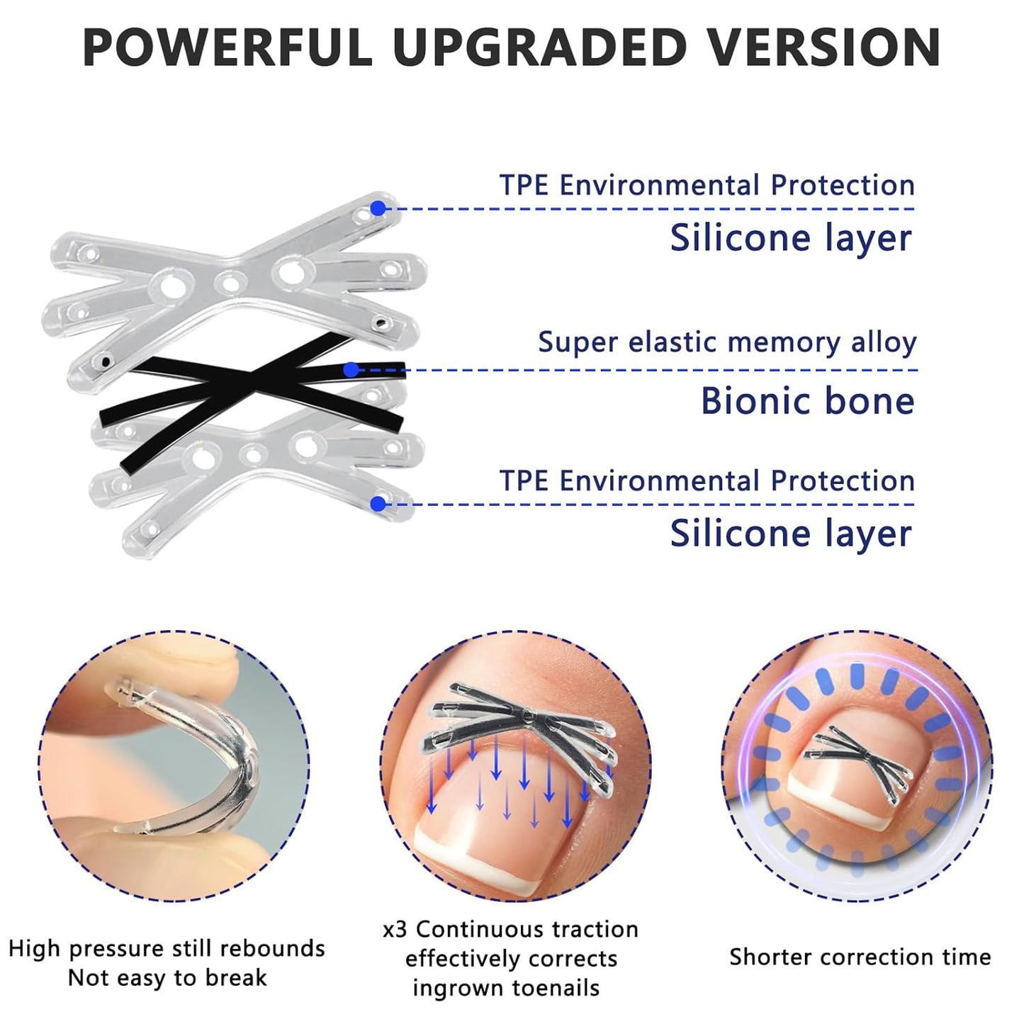 Upgraded MI-shaped Design Titanium Alloy Ingrown Toenail Corrector for Quick Pain Relief, Ingrown Toenail Treatment and Removal Tool Kit for Effective Curved Nail Repair, 6pcs