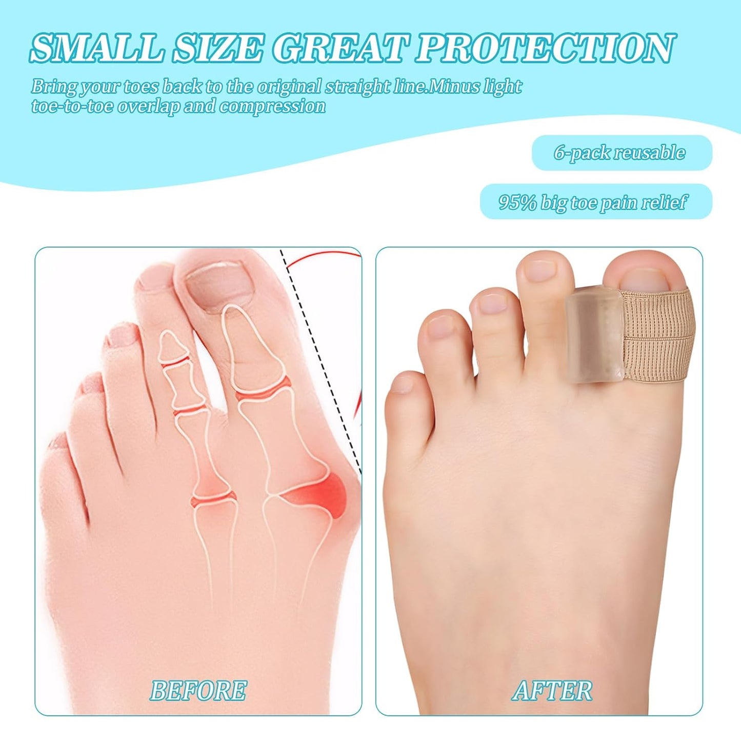 6PCS Gel Toe Spacers for Men and Women, Bunion Toe Separators for Overlap Toes, Bunions, Big Toe Alignment, Corrector and Spacer, Portable & Comfortable