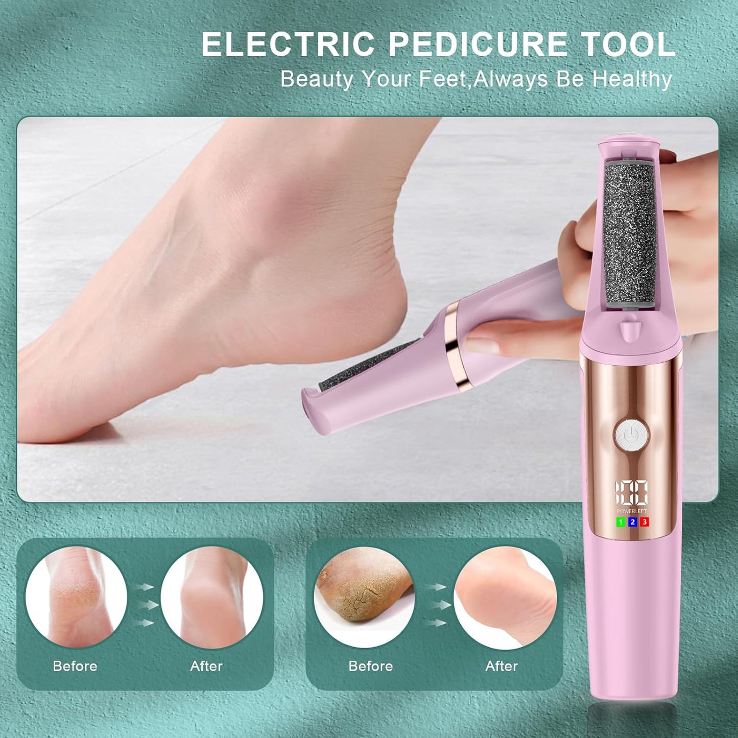 Electric Callus Remover for Feet, Professional Pedicure Tools Foot Care Kit, Foot Scrubber Electric Feet File Smooth Pedi Wand for Hard Cracked Dry Dead Skin, 3 Rollers, 3 Speeds,Ideal Gift
