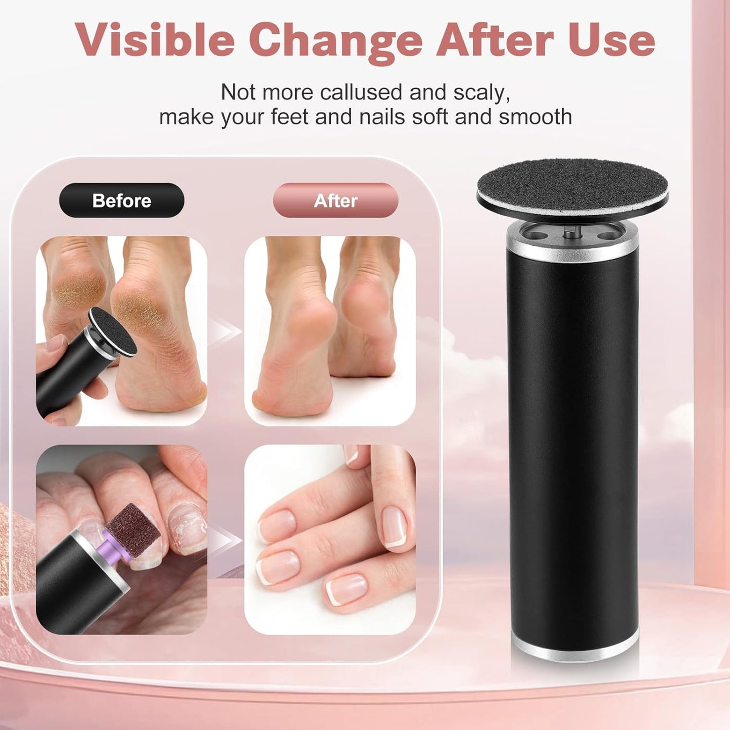 Electric Callus Remover for Feet, Foot File Grinder Tool with Replacement Sandpaper Disk and Nail Drill Bits, Adjustable Speed Foot Sander Pedicure Tools for Men Women Dry Cracked Hard Skin Calluses