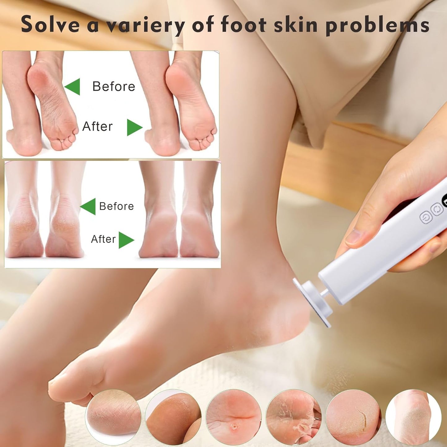 Cordless Electric Foot File Callus Remover - 6-Speed Heel Scraper for Cracked Heels,Painless Dead Skin Remover for feet, Rechargeable Foot Grinder Professional Pedicure Tools Kits for feet (Black)