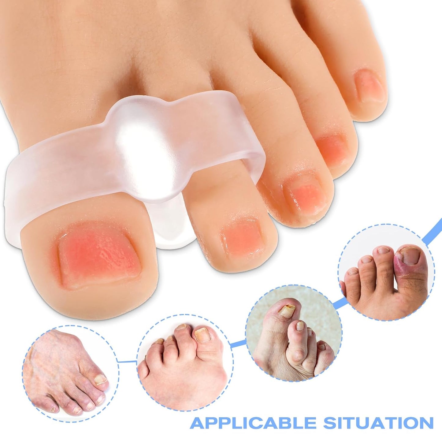 Bunion Corrector Gel Toe Separators with 2 Loops Silicone Big Toe Spacers Suitable for Bunion and OverlapToe (Pack of 12)