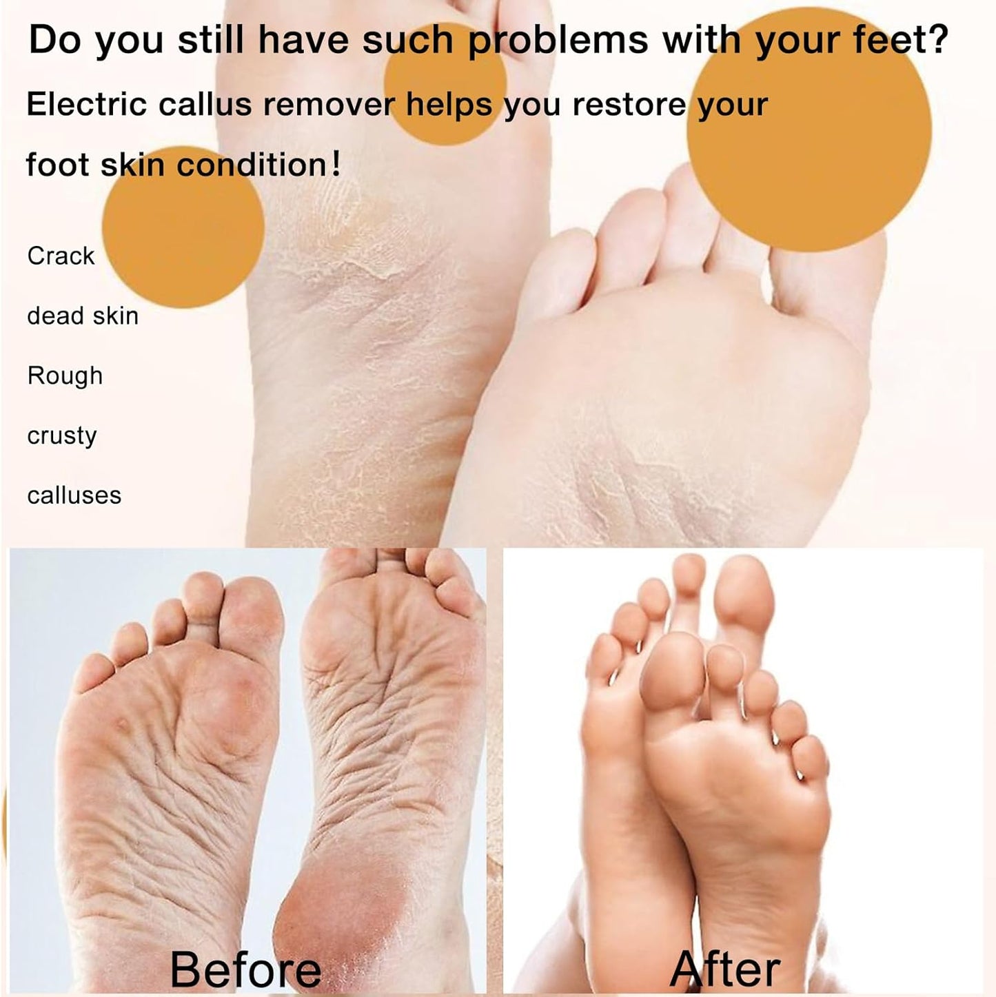 Electric Callus Remover Foot File, 2024 New USB Rechargeable Foot Repair and Grinding Device, Heel Polisher Digital Display, Feet Callus Remover, for Men Women Dry Callus Dead Skin (Blue)