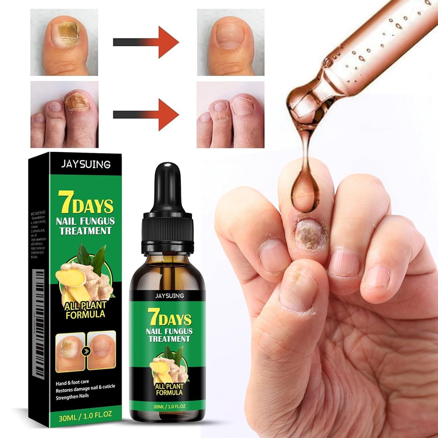 7 Day Nail Treatment, Nail Strengthener and Growth & Oregano Tea Tree Oil for Toenail: Safely and Gently, Daily Maintenance