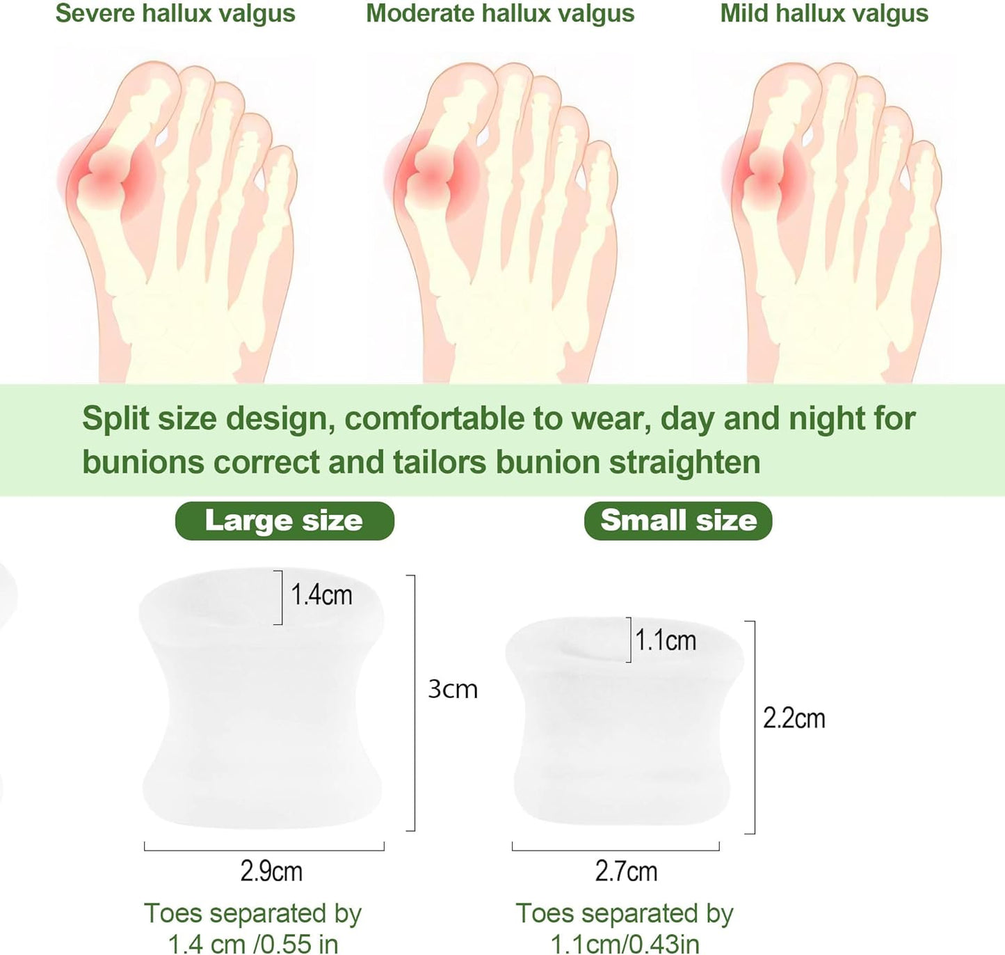 FOYOLO Gel Toe Separators and Flared Bunion Spacers 8PCS Temporary Bunion Corrector,Toes Splint Gel Toe Spacers for Overlapping Toe and Curled Toes,Stay in Place-(2 Small & 6 Large Size-Clear)
