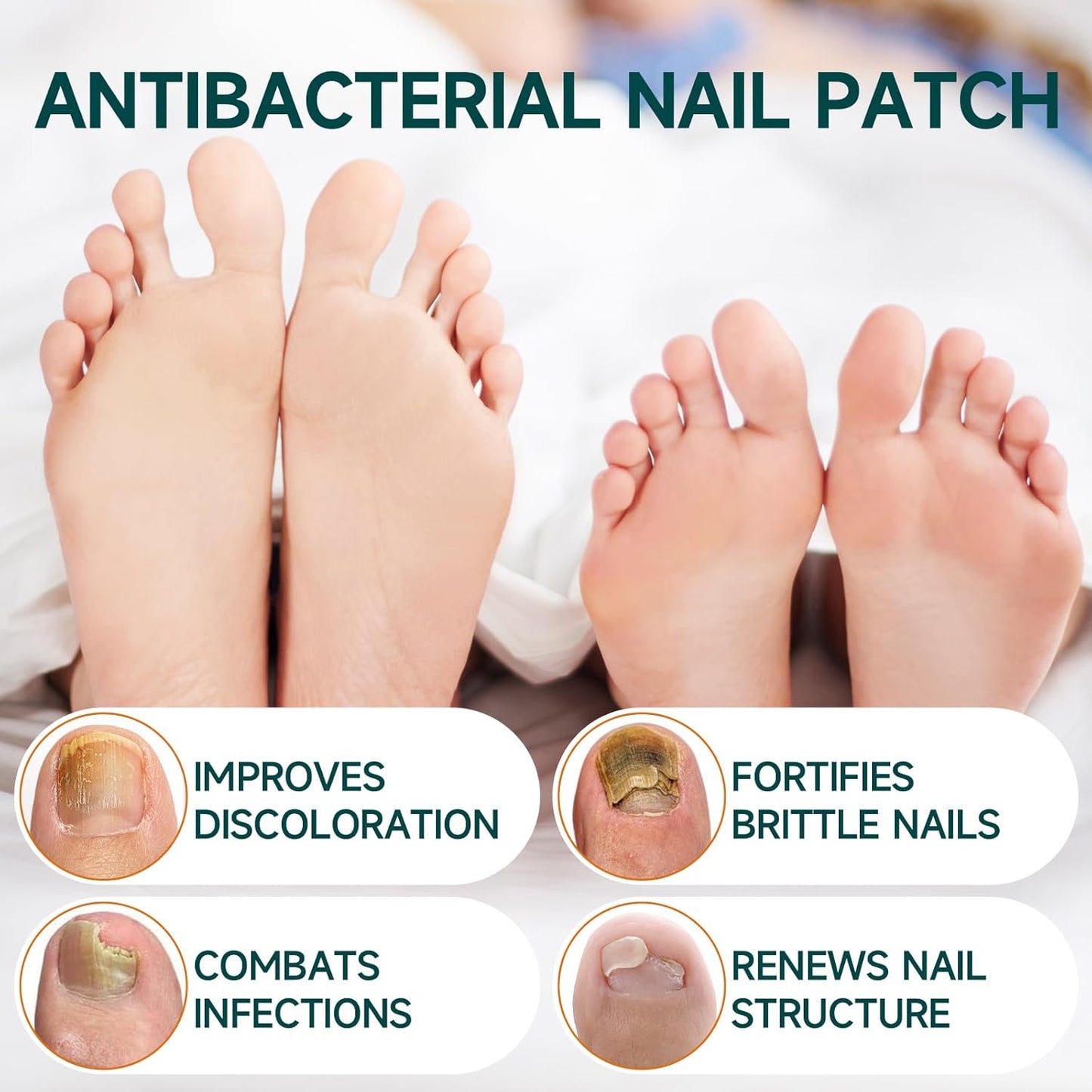 32 Pcs Fungal Nail Patches, Toenail Fungus Treatment Extra Strong Formula, Nail Repair for Damaged Nails, Overnight Renewal for Men and Women
