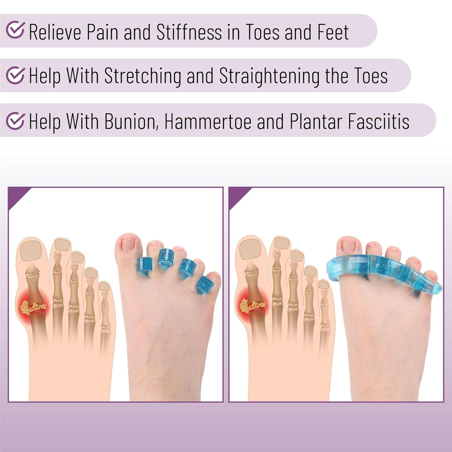 Dr. JK- ToePal Gel Toe Separator, 4 Pairs, Blue, Toe Spacers, Bunion Corrector, Christmas Gifts
