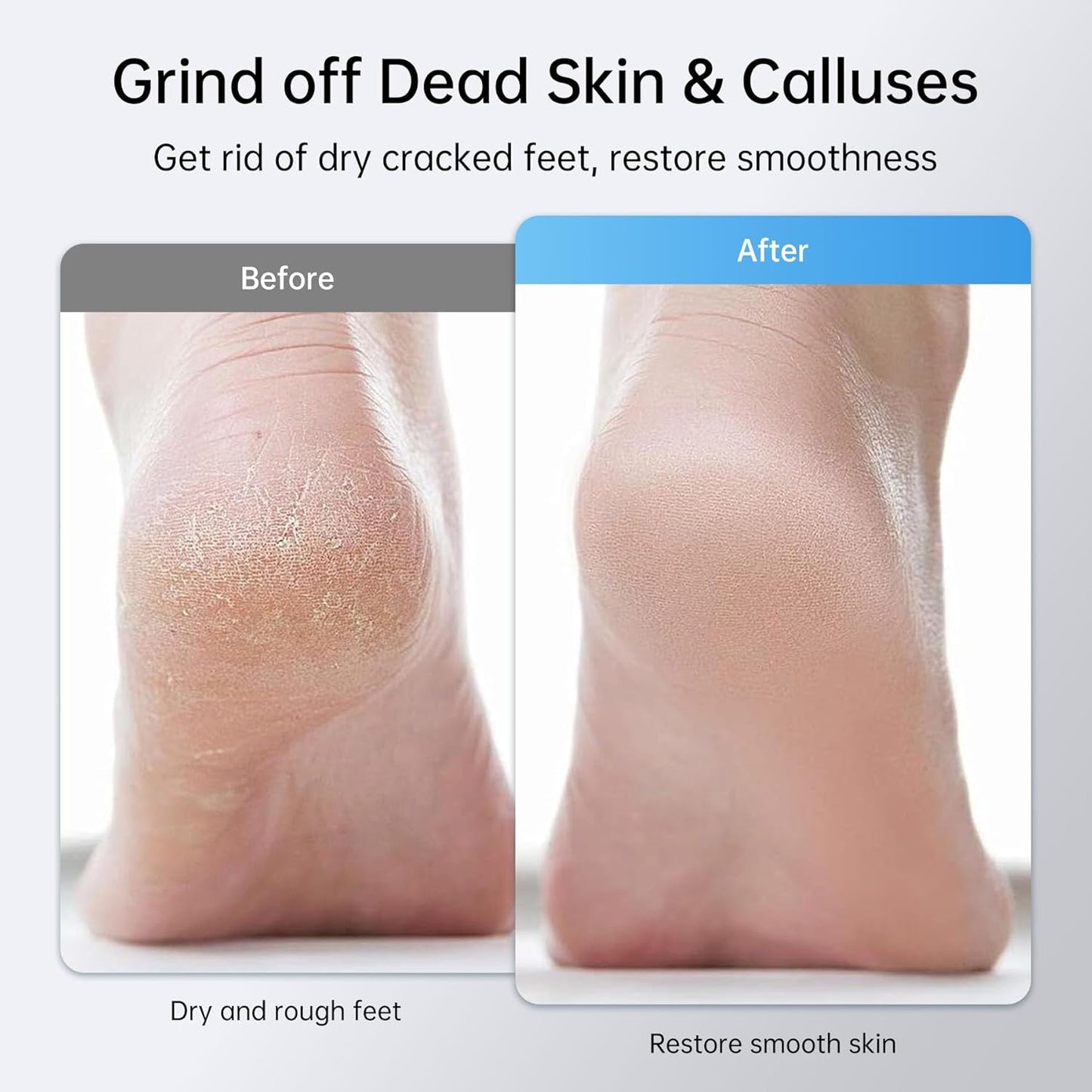 Rechargeable Electric Callus Remover for Feet - Replaceable Sandpaper Professional Foot Grinder 6 Speeds Adjustable Foot Sander, Cordless Electric Foot File Pedicure Tools for Dead Skin, Cracked Heels