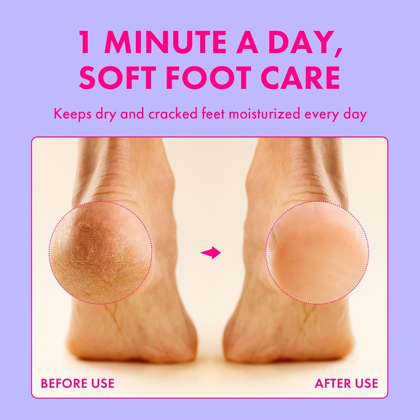 Foot Cream for Long-Lasting Odor Control | Neutralizes Odor at the Source | Hydrates Dry, Cracked Heels for Soft, Healthy Feet | Natural Mushroom Formula
