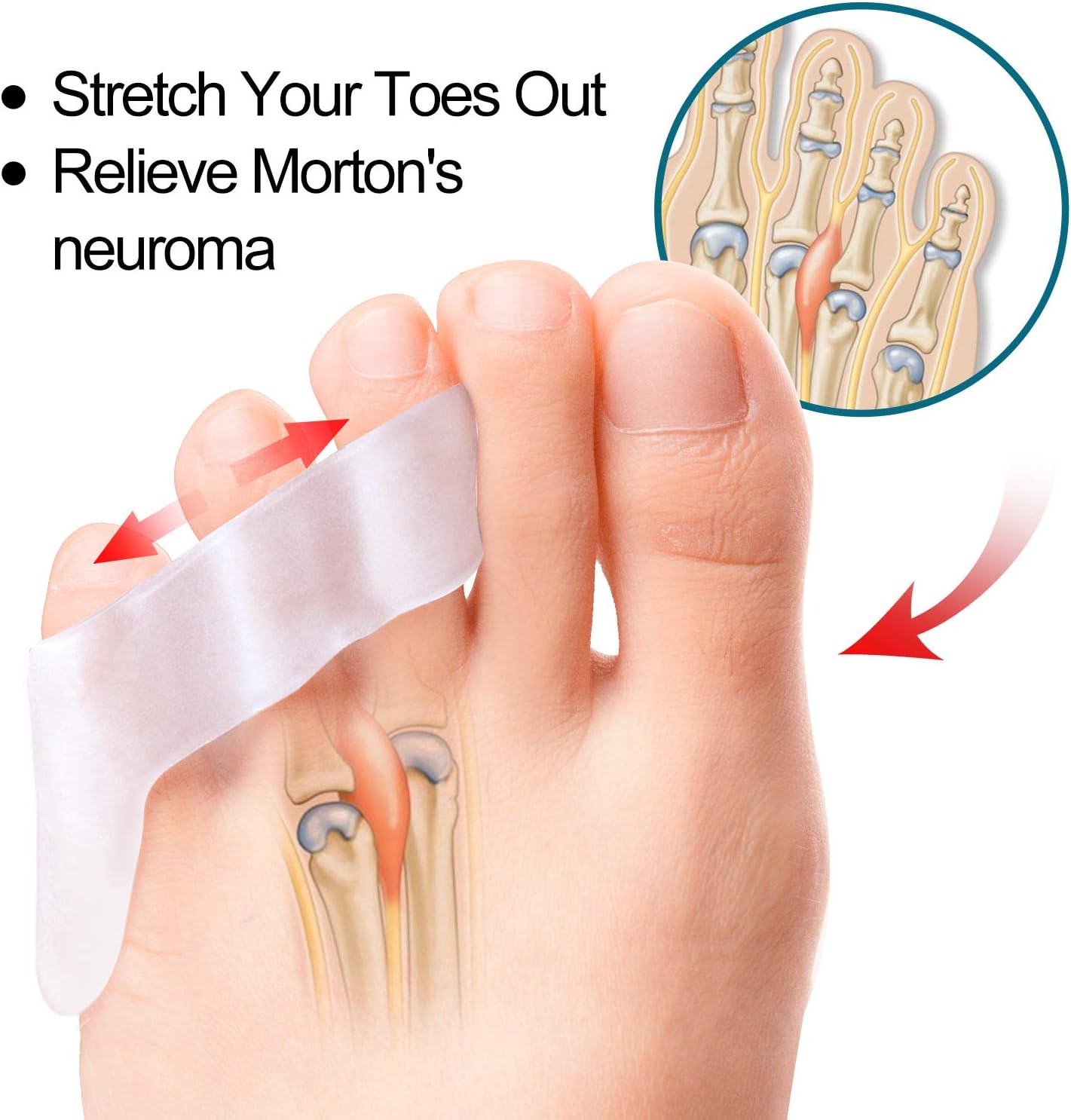 Povihome 10 Pack Pinky Toe Separator and Protectors, Triple Gel Toe Separators for Overlapping Toe, Curled Pinky Toes Separate and Protect