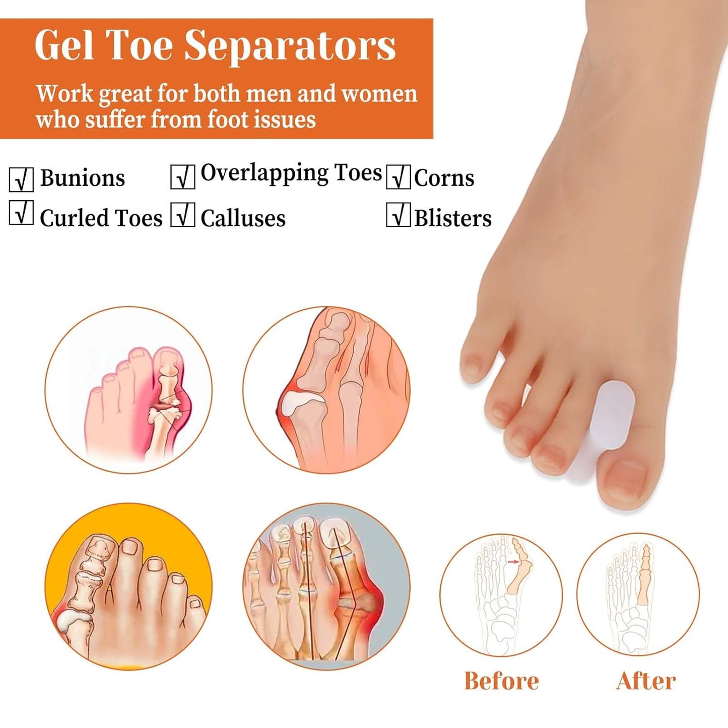 12Pcs Bunion Corrector Gel Toe Separators Soft Toe Spacers Overlapping Toes Pads Gel Orthotics for Men Women Sports Activities Calluses Crooked Toes Hammertoe Straighten Pain Relief